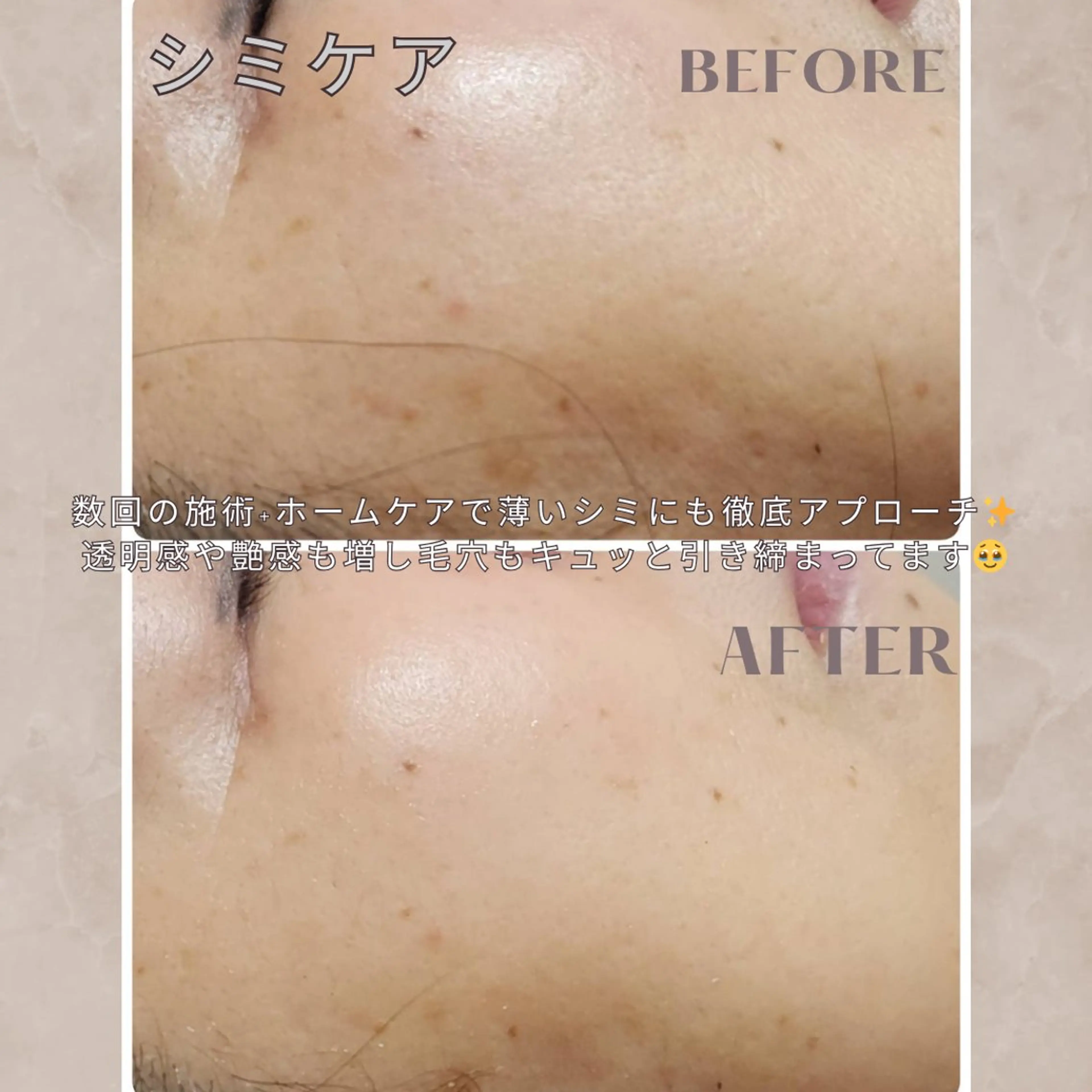 エステ 大橋 唯のエステ・リラクイメージ