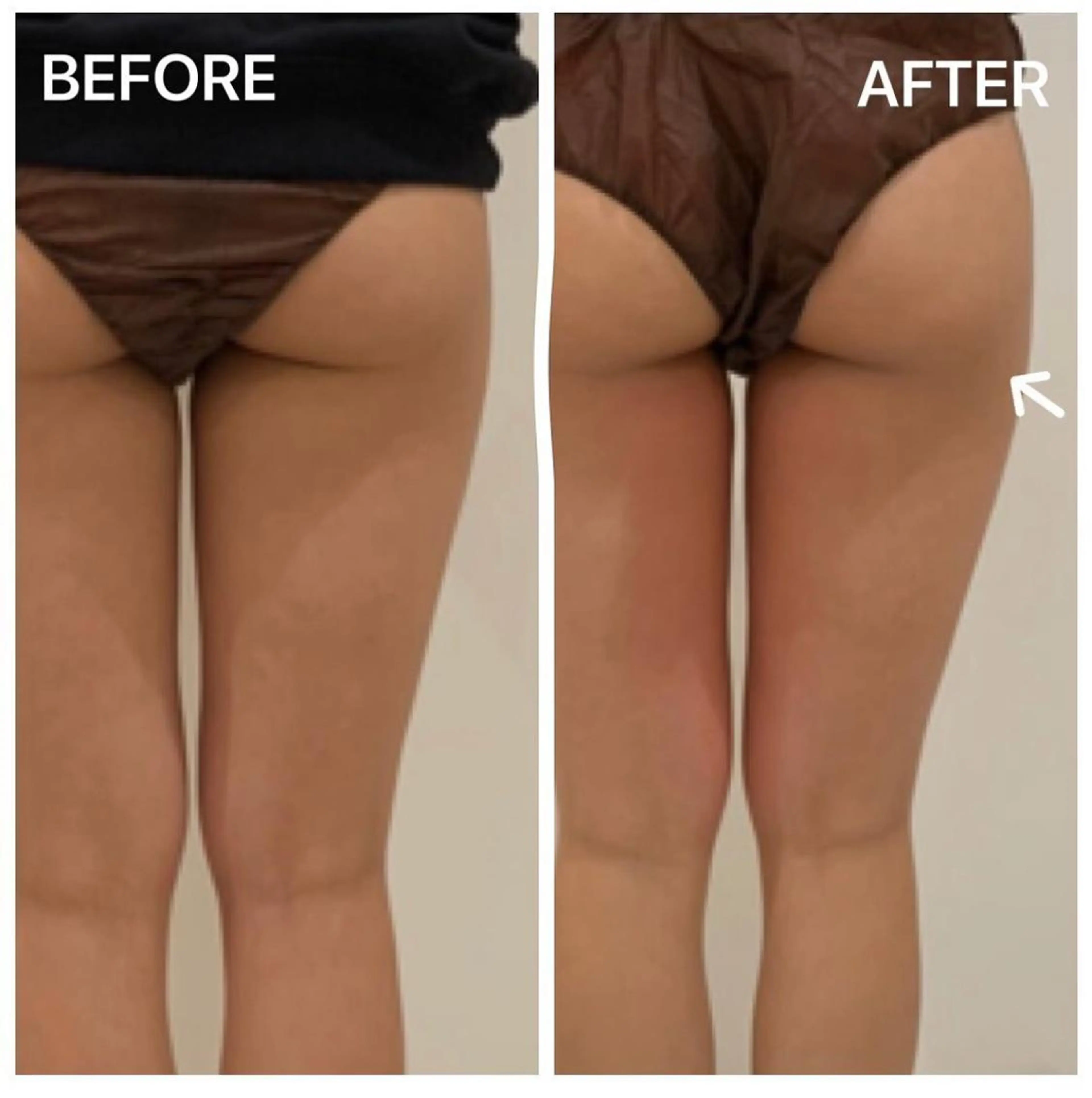 Porte beauteオーナーのエステ・リラクイメージ