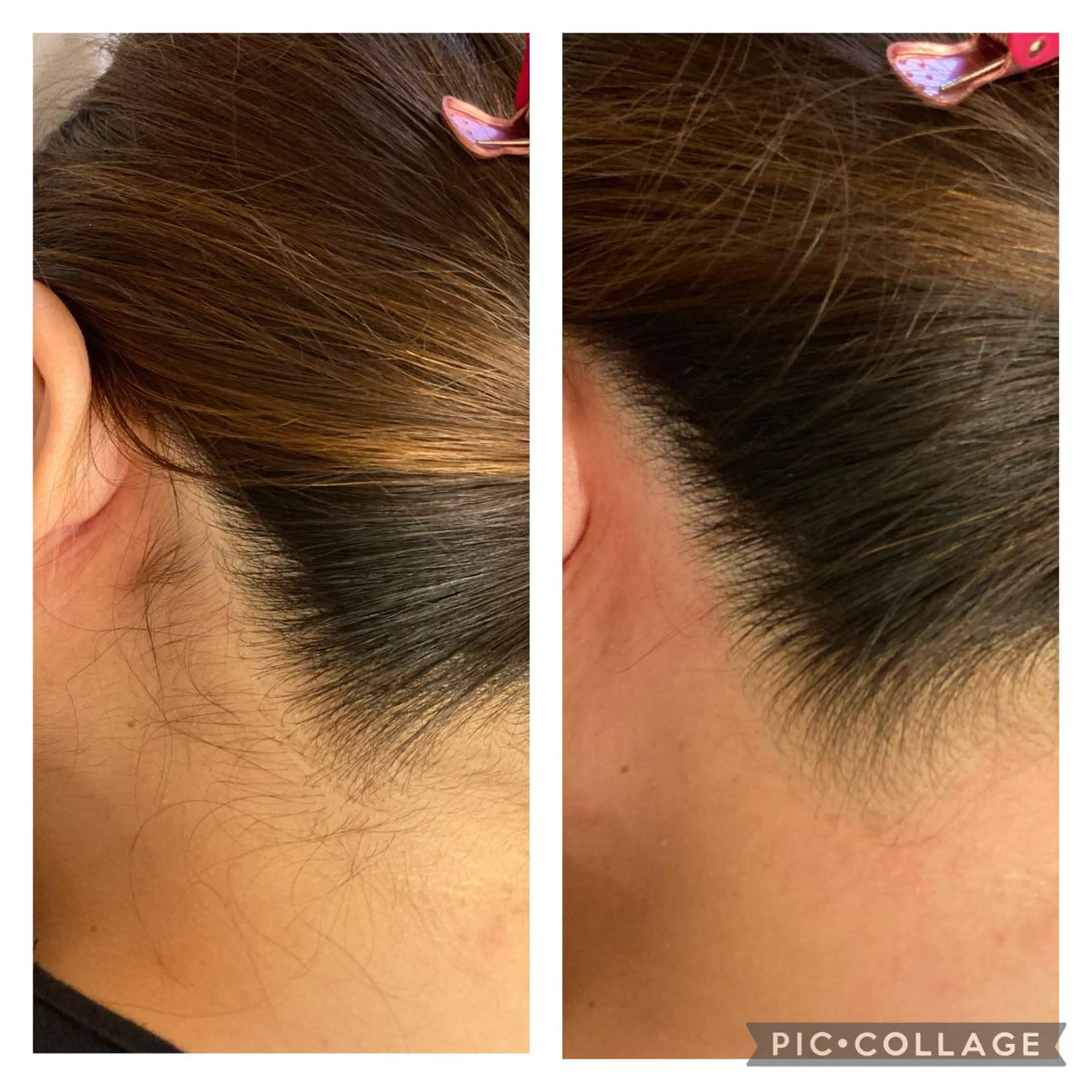 脱毛 MARI シュガーリストのエステ・リラクイメージ