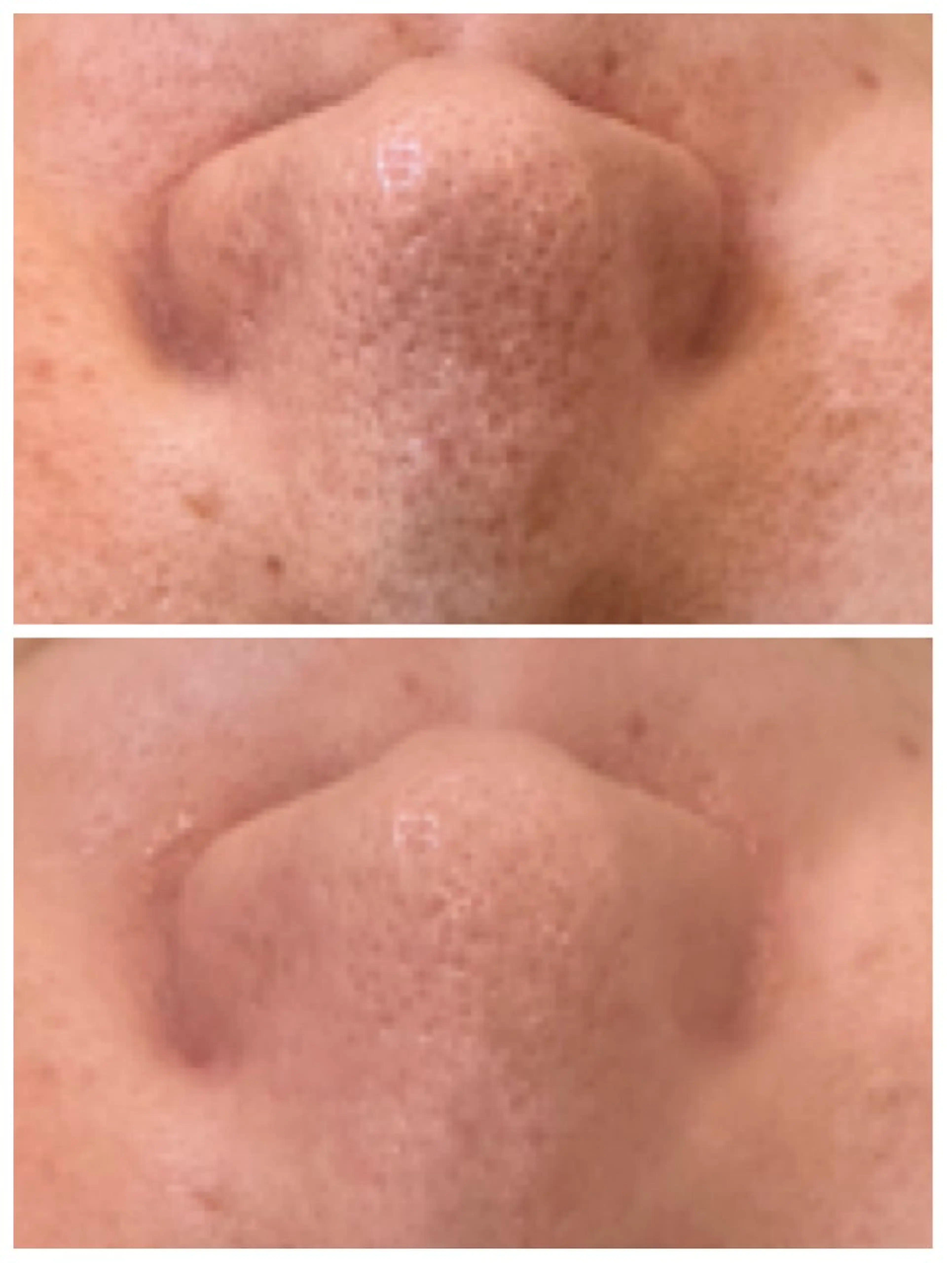 エステ トータルビューティ サロンstageのエステ・リラクイメージ