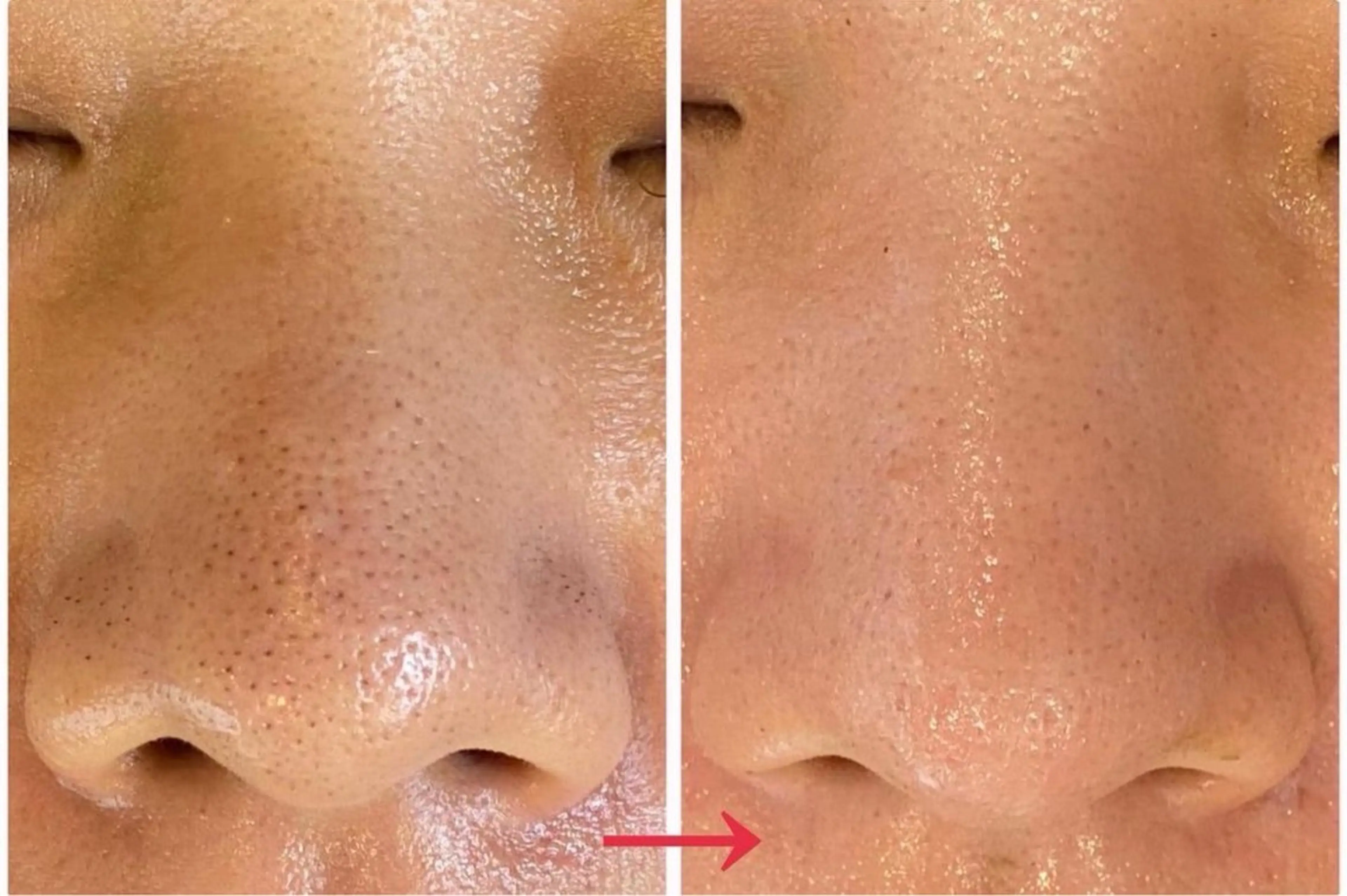 肌質改善サロン Manaririoのエステ・リラクイメージ