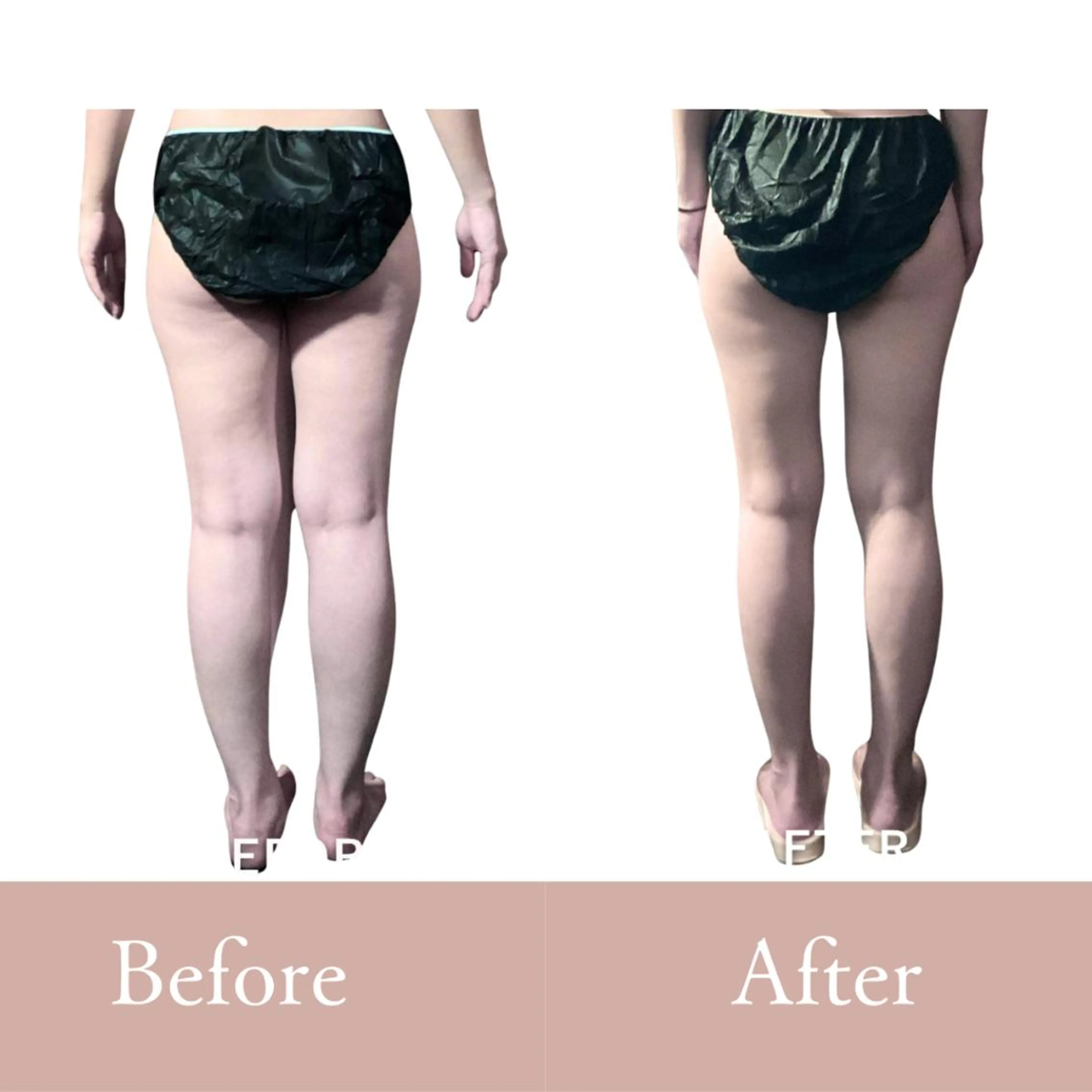 今だけ🔥1ヶ月集中下半身ダイエットモニター3名様募集！！の写真