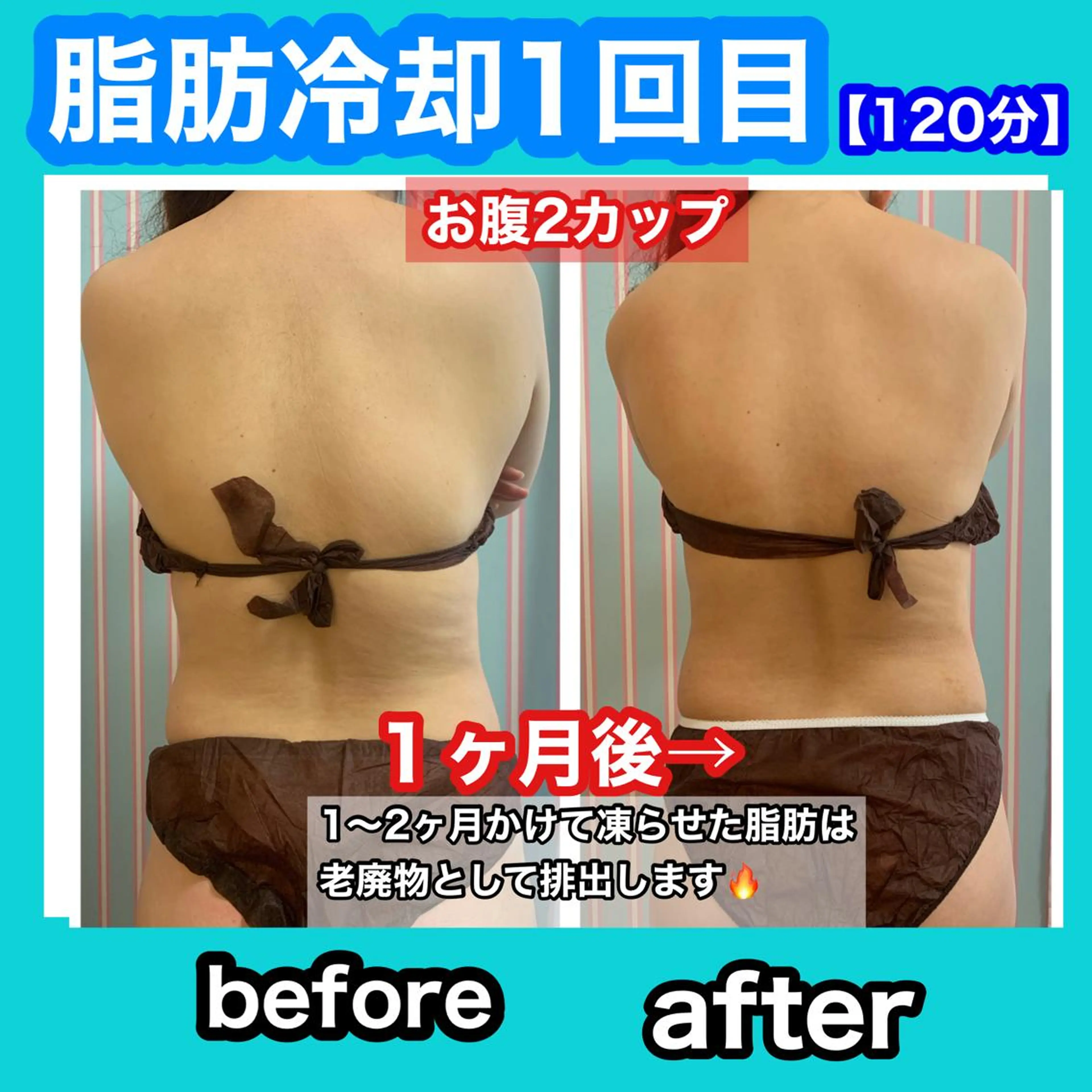 エステ 痩身/脱毛/ネイル HARUKAのエステ・リラクイメージ