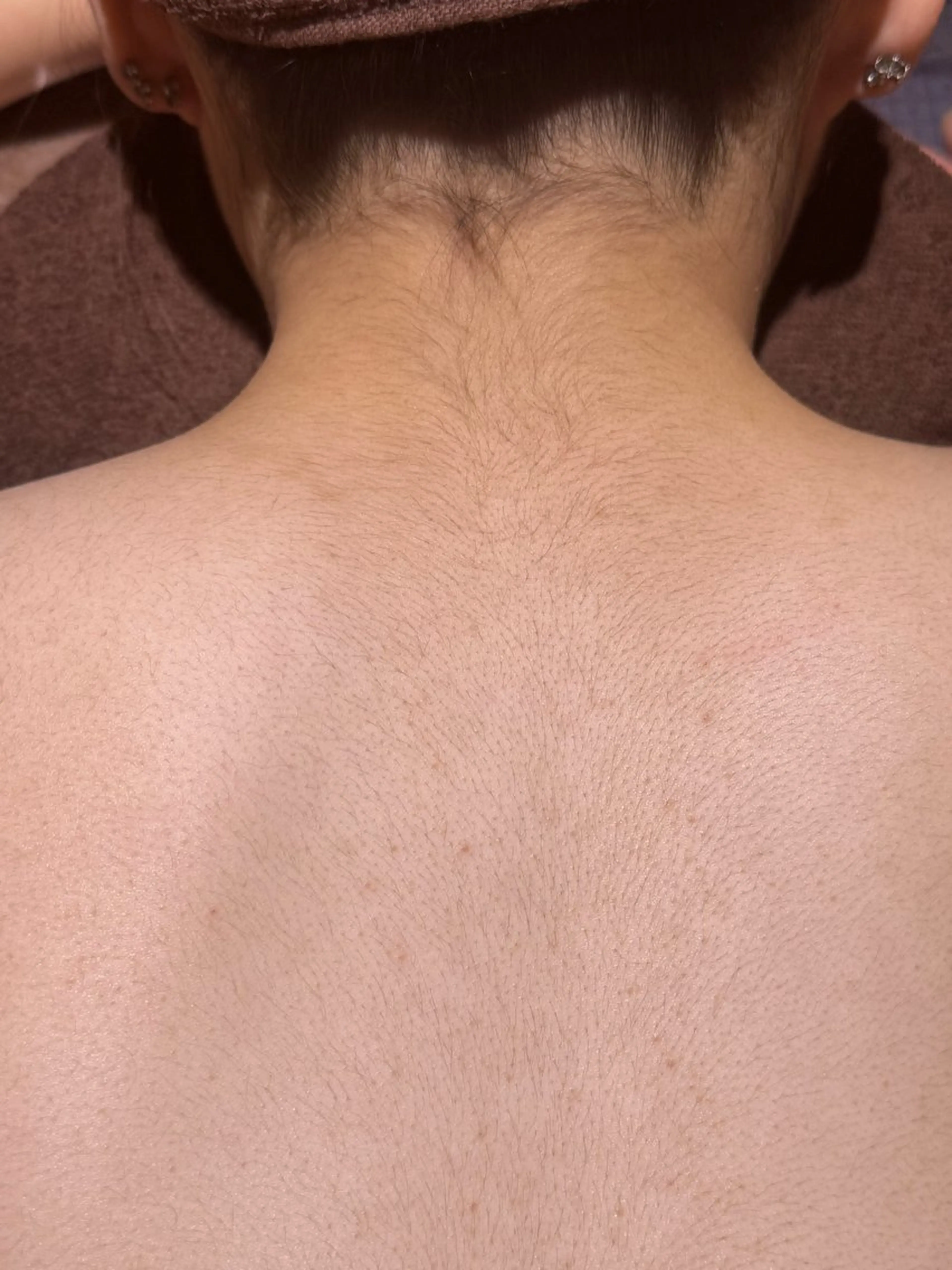 キッズ 脱毛 下赤塚 ベルミーランドのエステ・リラクイメージ