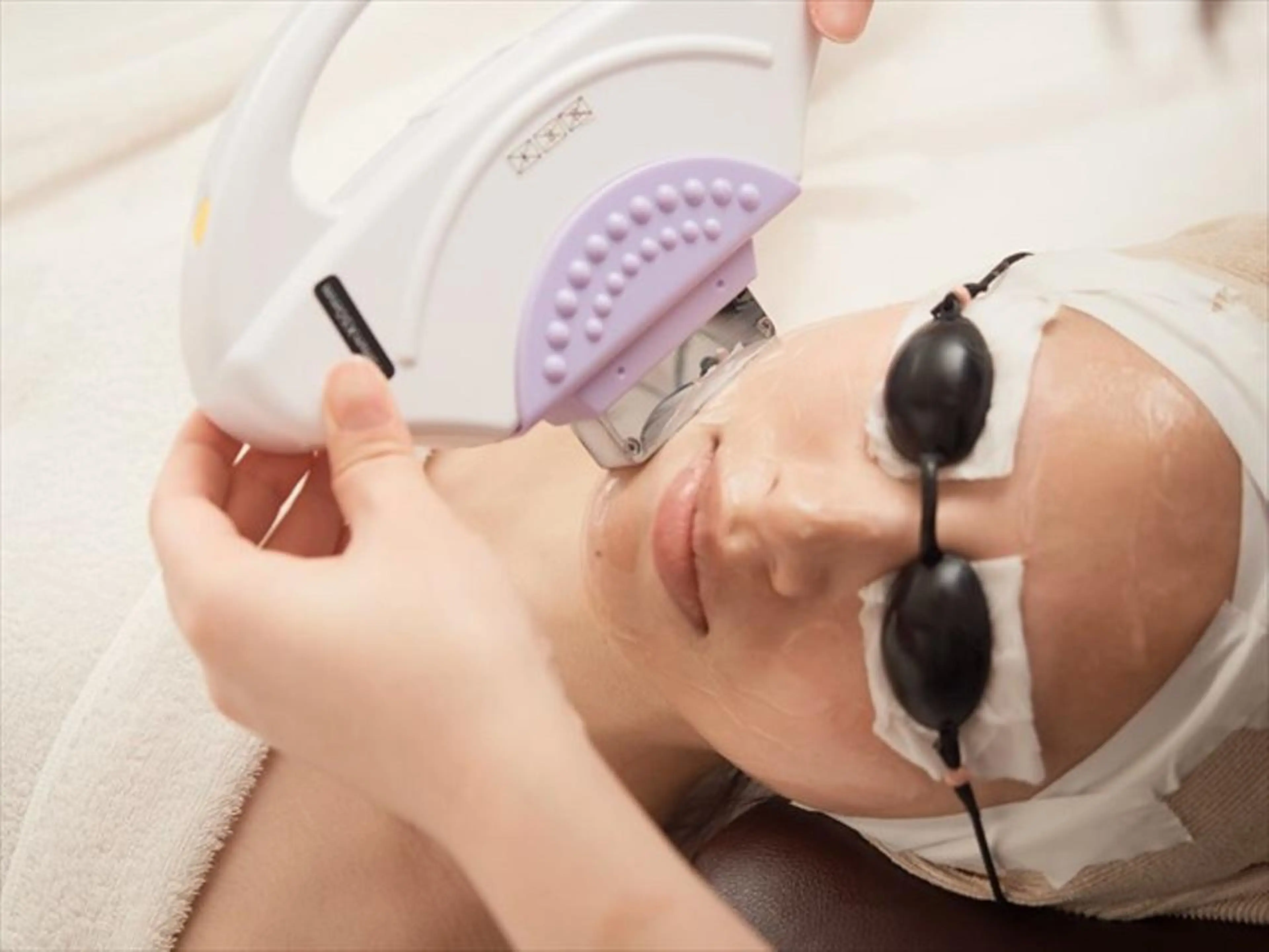 【ミニモ限定】美容液のパック付き☆レディース顔脱毛(頬、口周り、額、もみ上げのセット)の写真