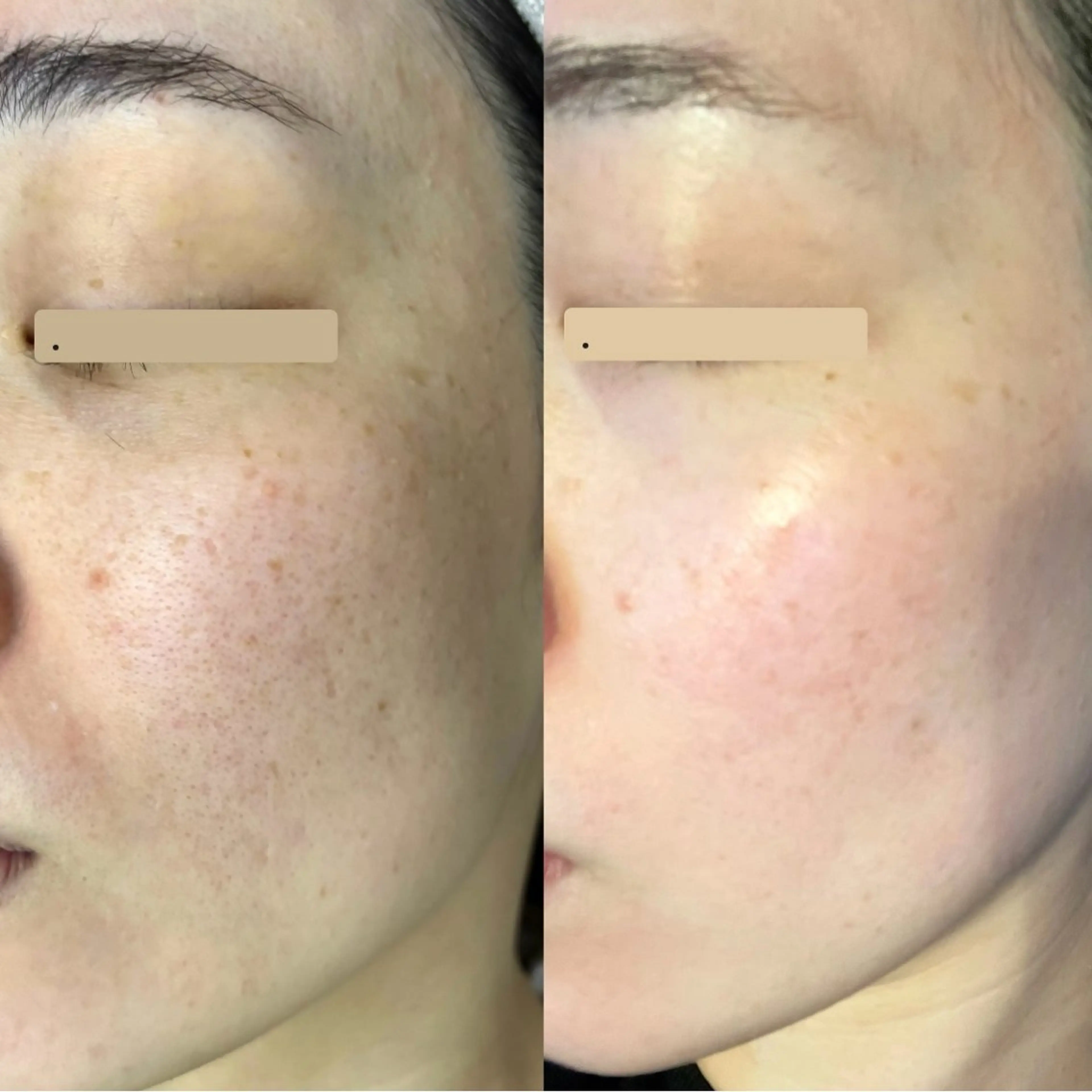 カムイ所属・カムイ 山﨑のエステ・リラクイメージ