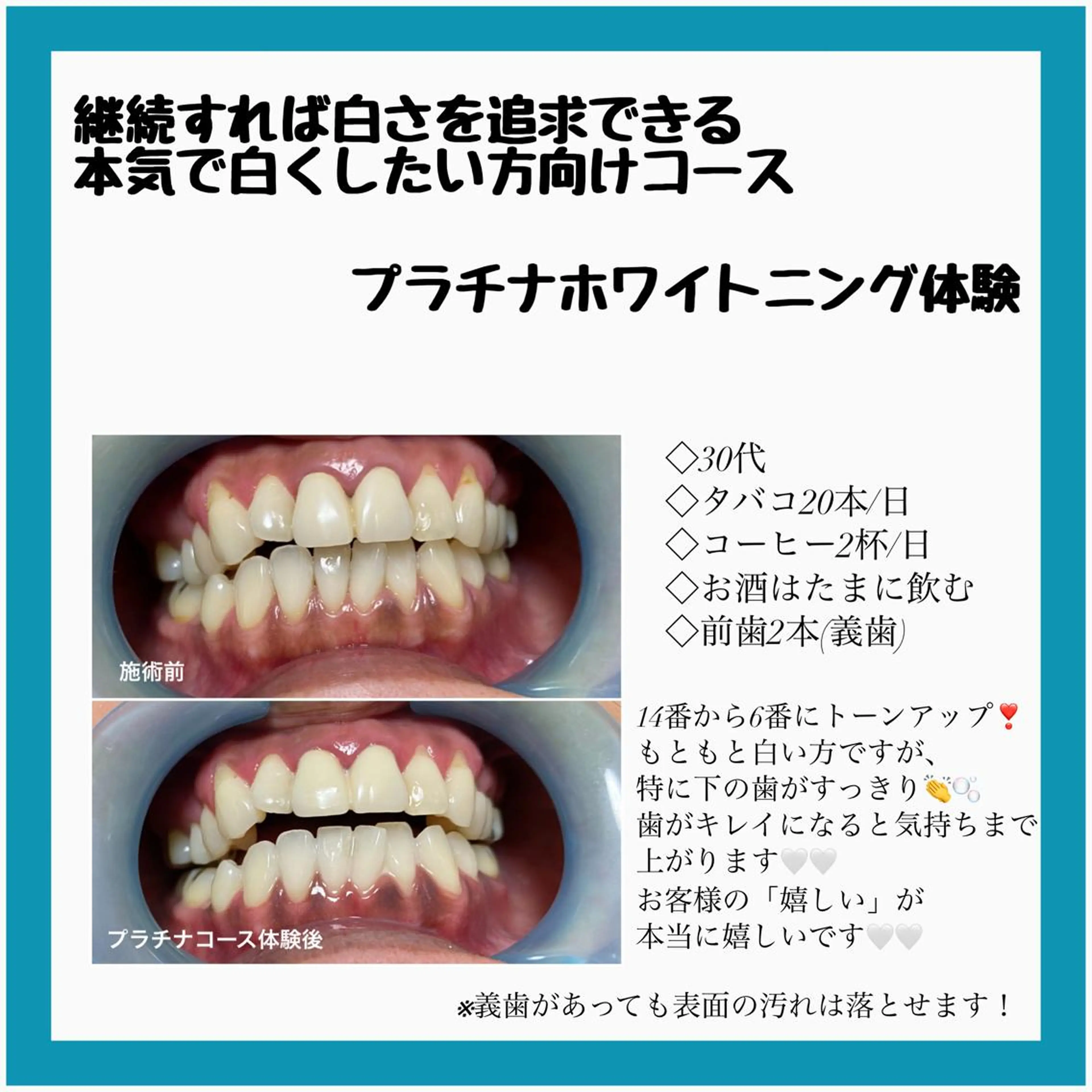 ネイル/耳つぼ /新ホワイトニングのネイルデザイン