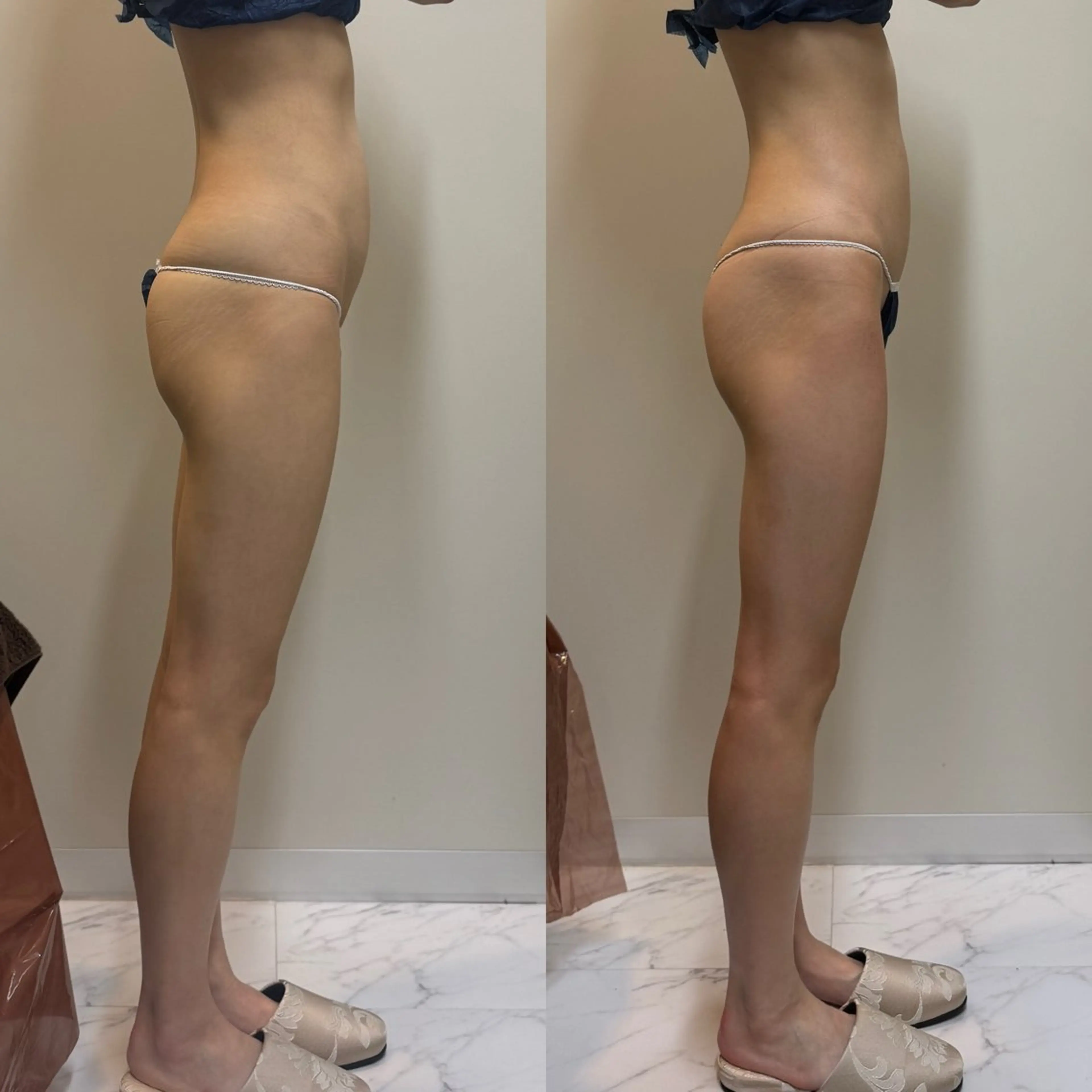 Cherie Tokyoのエステ・リラクイメージ