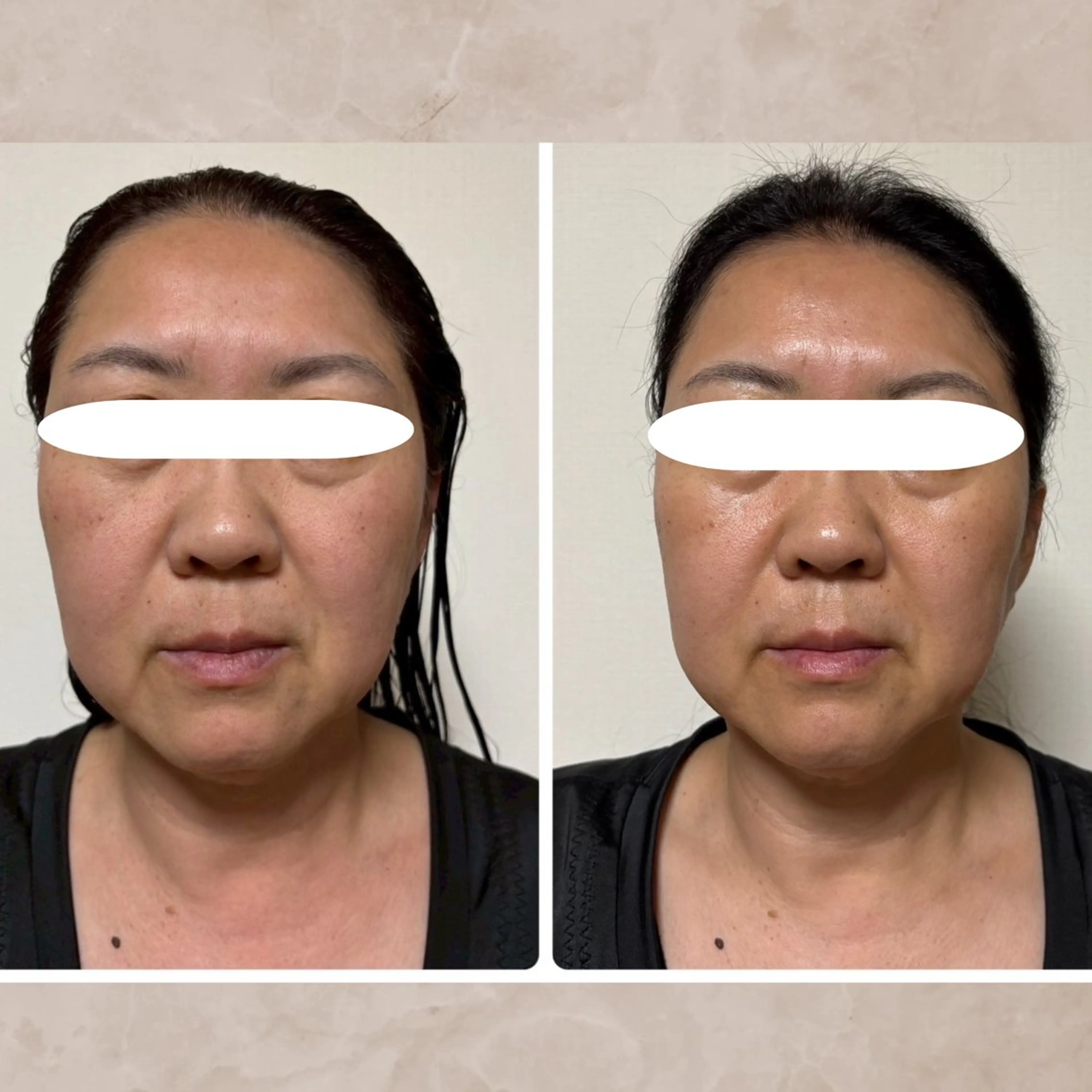 エステ リラク Total Beauty Salon Vi's CLUB by BINEL所属・Vi's CLUB KOTONOのエステ・リラクイメージ