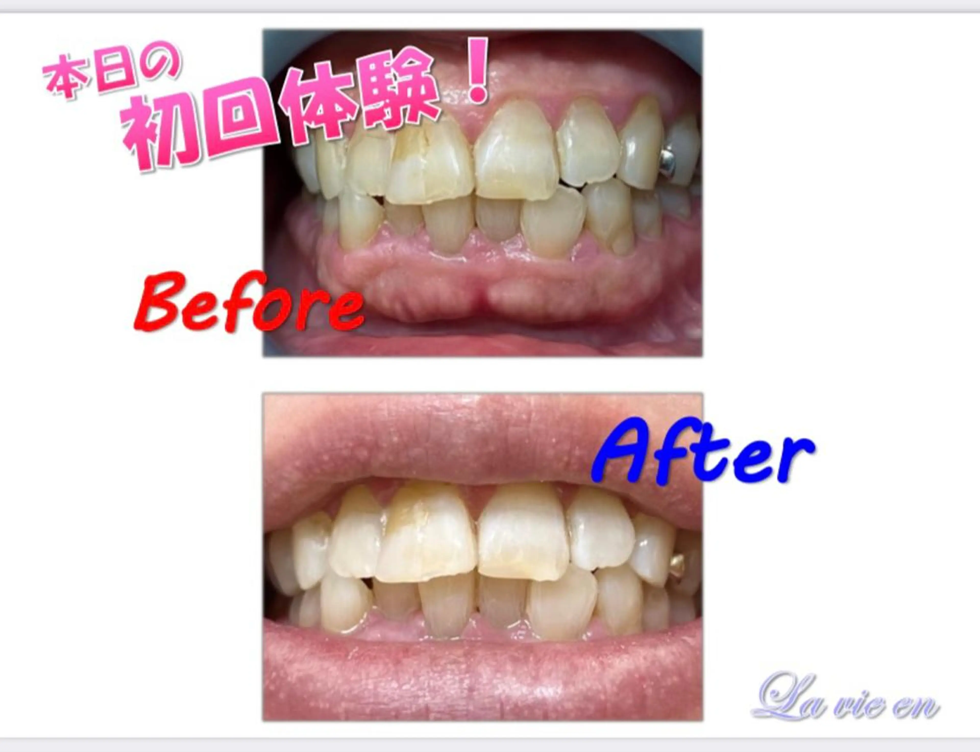 その他 セルフホワイトニングサロン　ラヴィアン所属・ホワイトニングサロン La vie enのその他イメージ