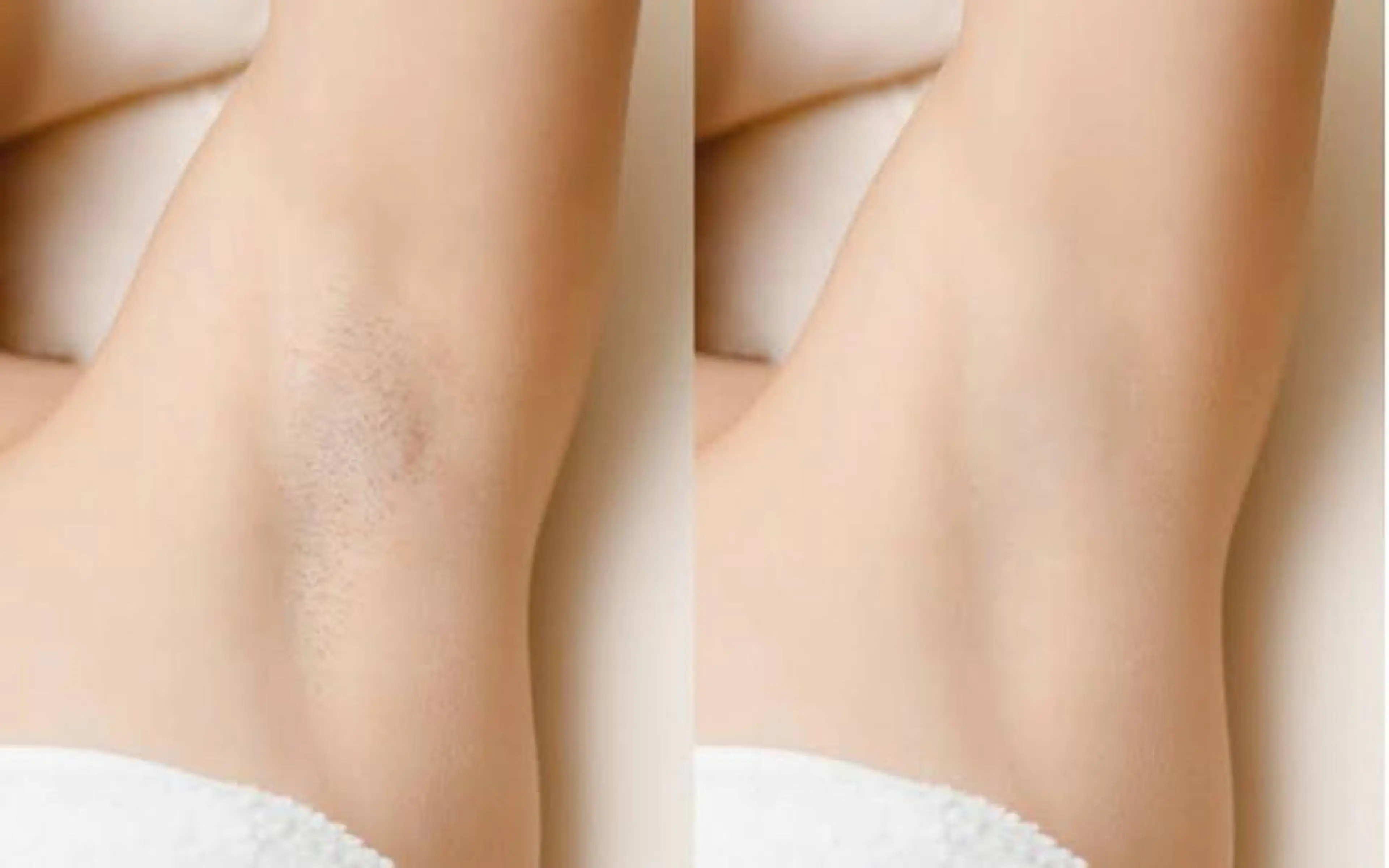 脱毛 美肌脱毛サロン　琥珀所属・トータルビューティー 琥珀のエステ・リラクイメージ