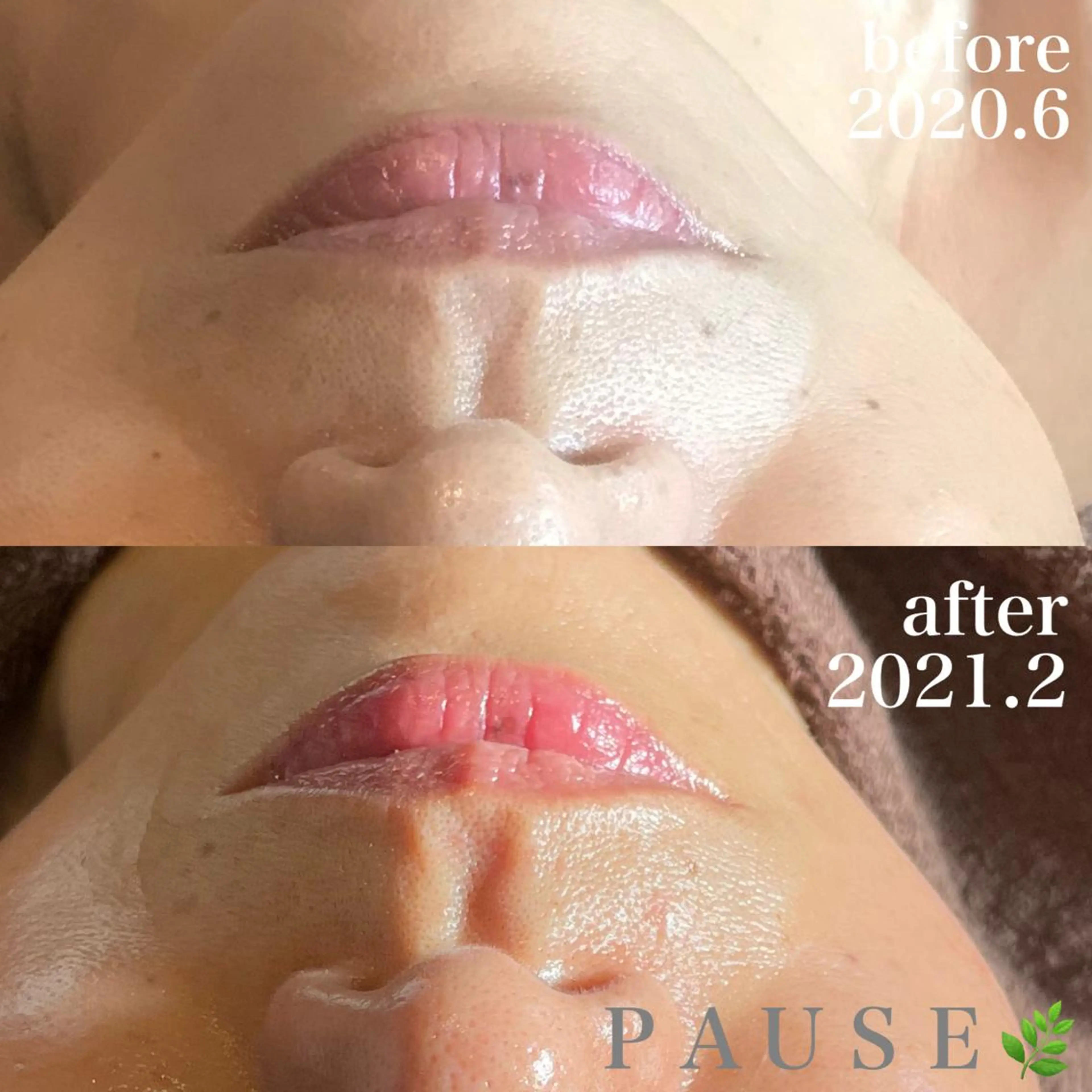 エステ 浜野 恵美のエステ・リラクイメージ