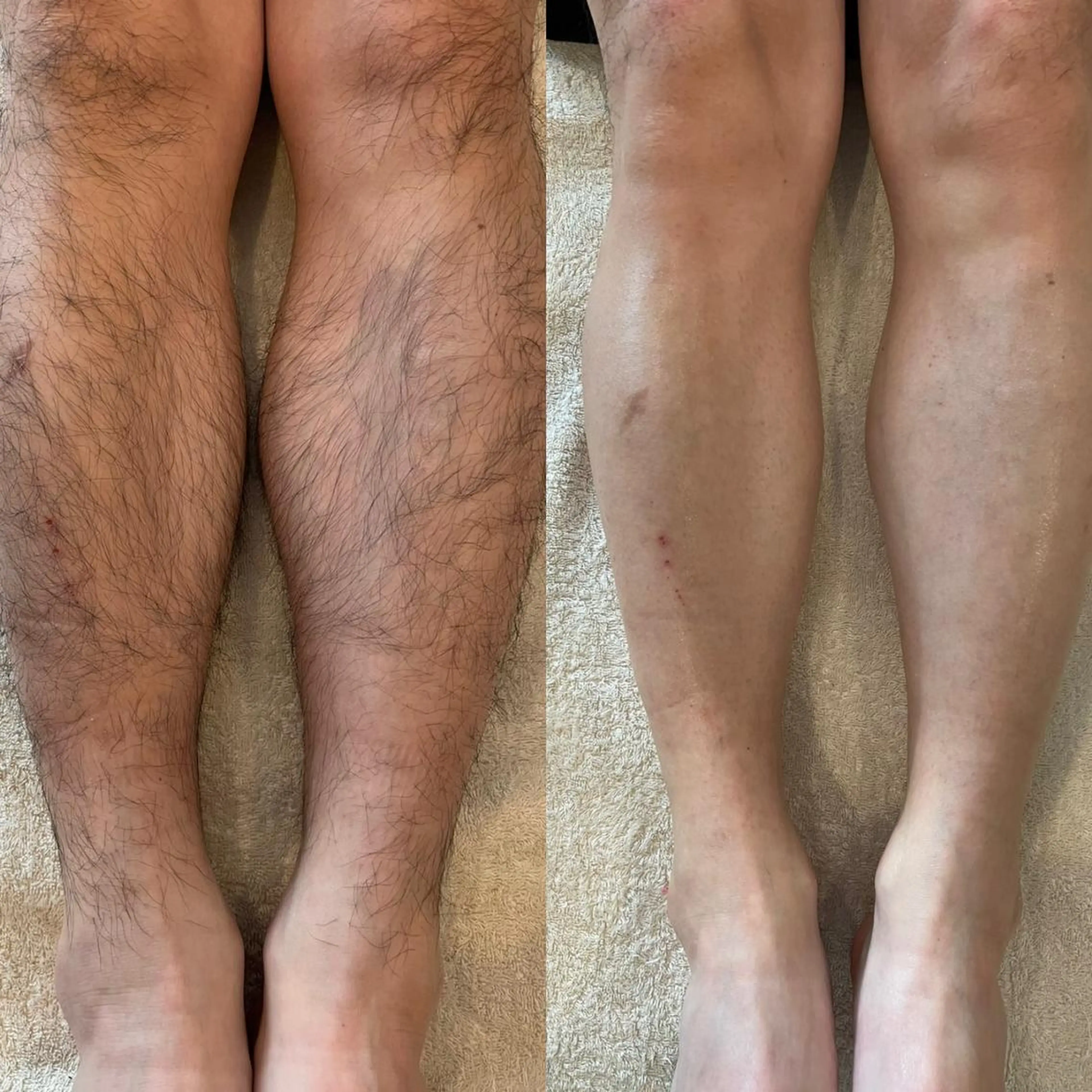 アイブロウ ワックス脱毛 WAX＆光脱毛/瘦身 アイブロウ/牧野亞紀の眉毛・アイブロウイメージ