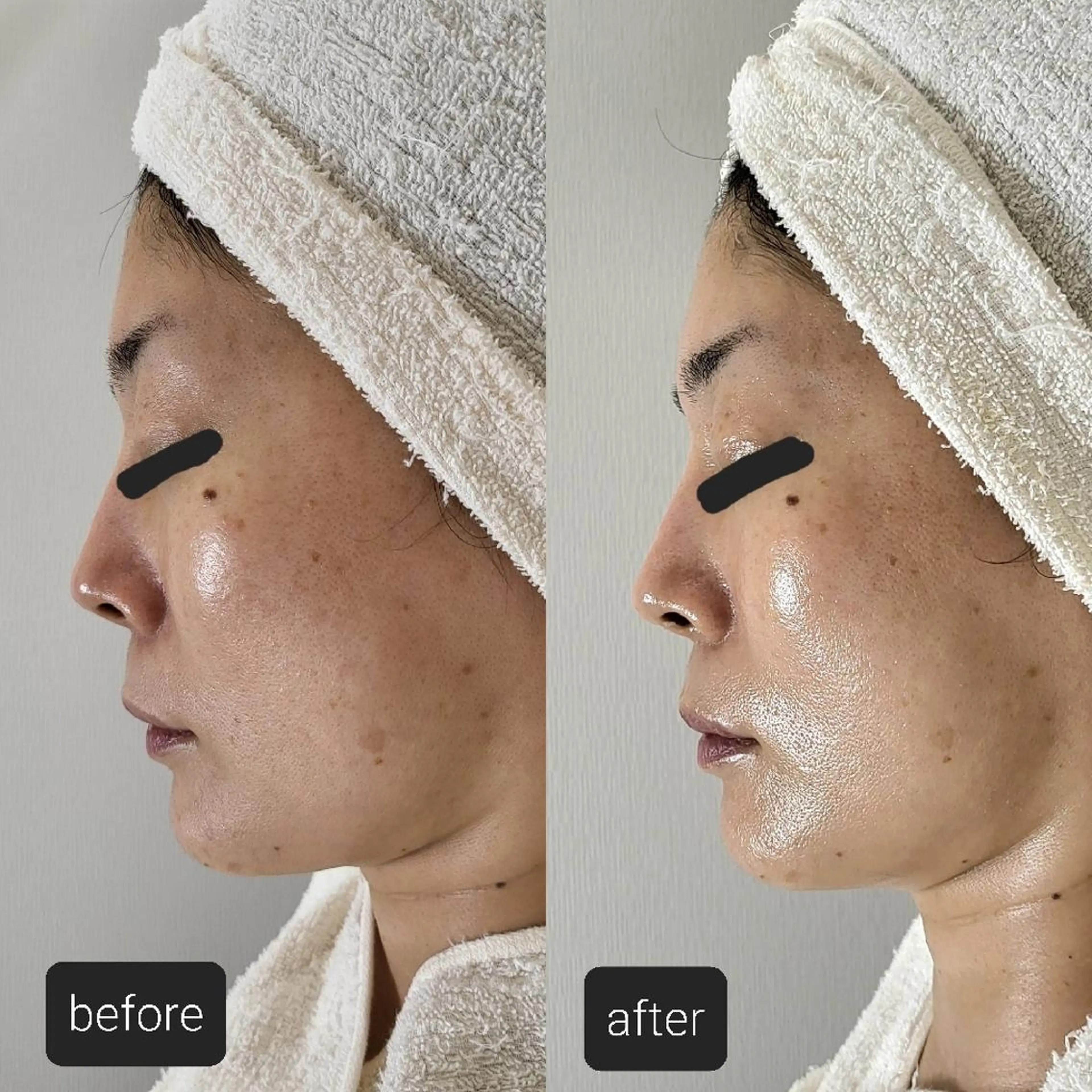 ニキビケア＆ニキビ跡 レゾン京橋店　のエステ・リラクイメージ