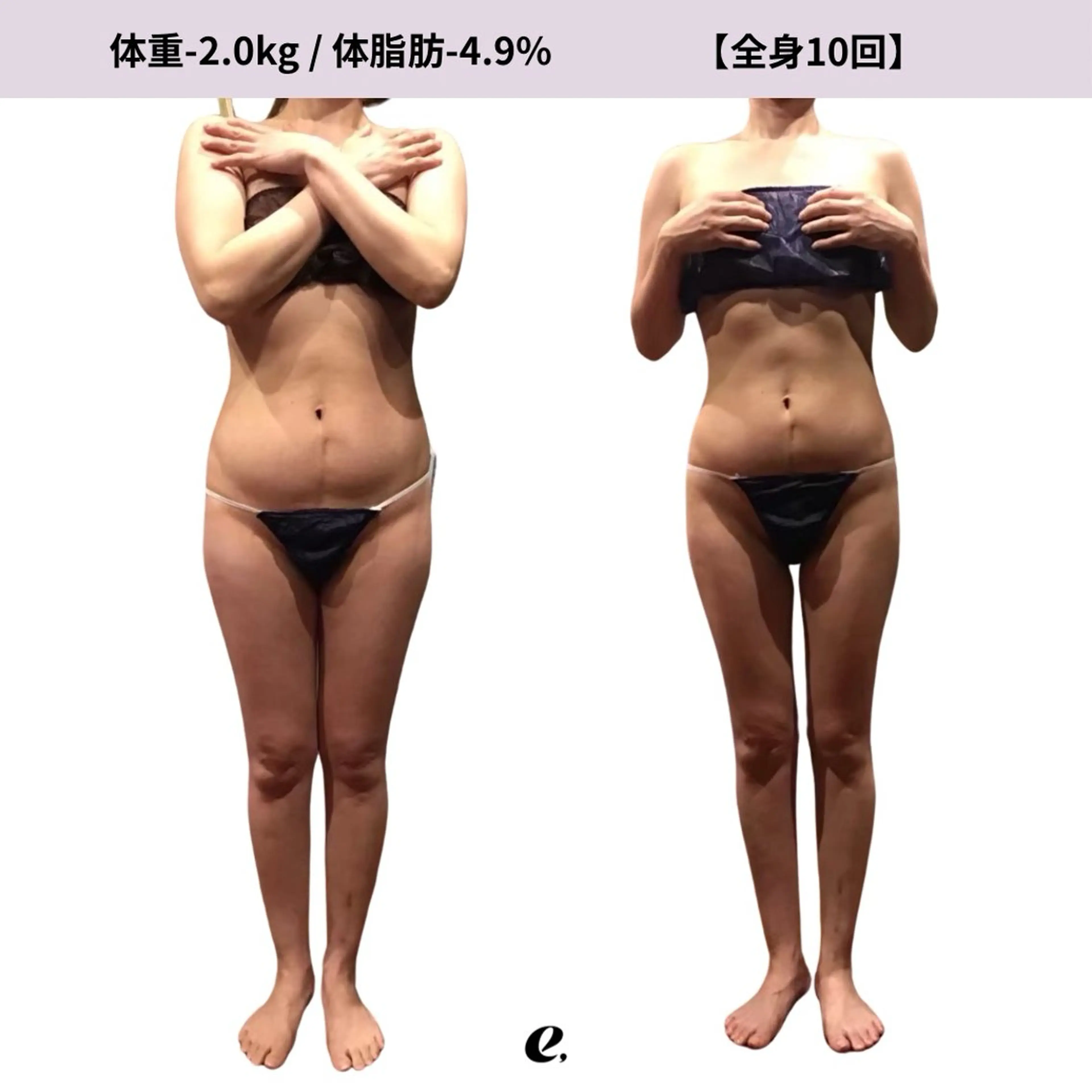 エステ リラク espresso,所属・《痩身、小顔専門店》 エスプレッソのエステ・リラクイメージ