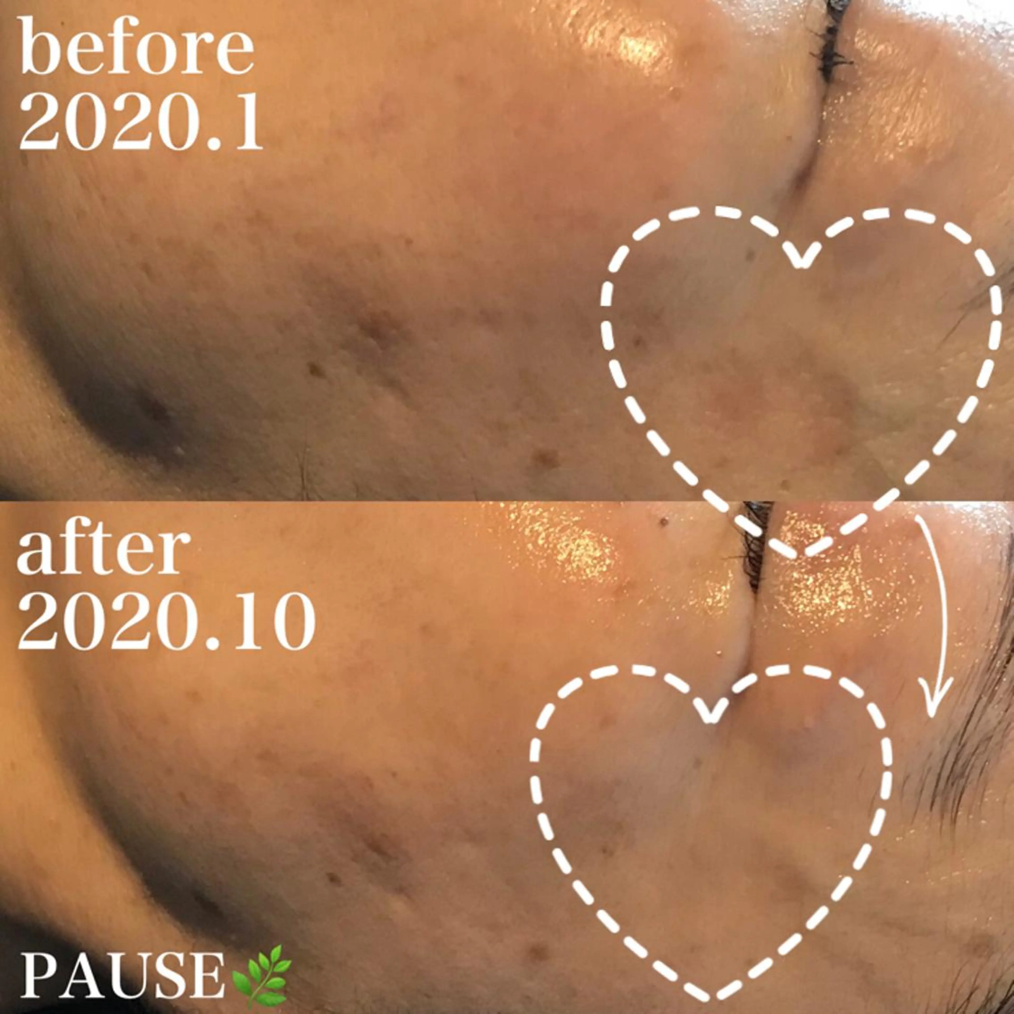 エステ 浜野 恵美のエステ・リラクイメージ