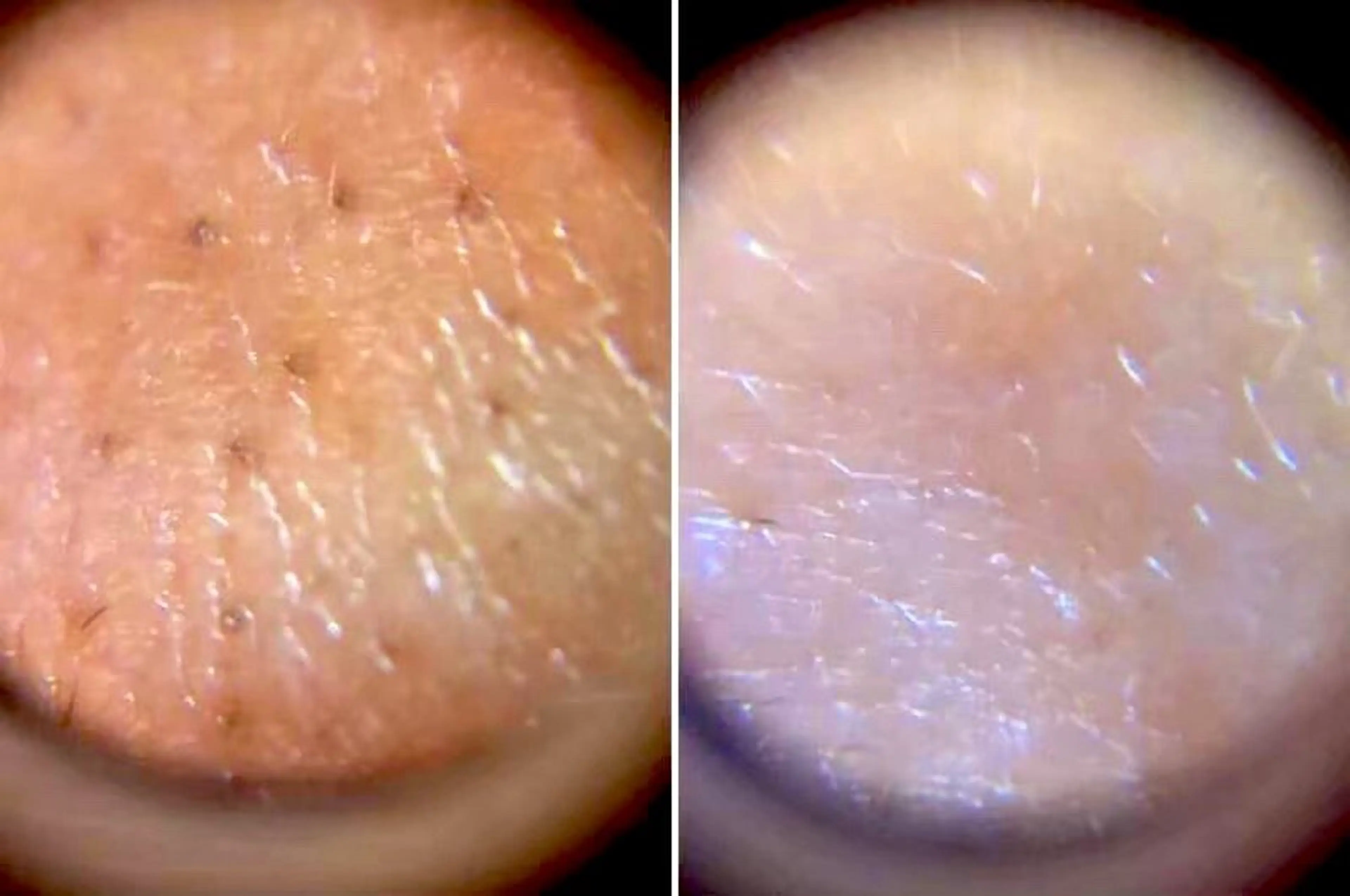 『SNSでも大人気✨』ルミスパ洗顔体験🫧の写真