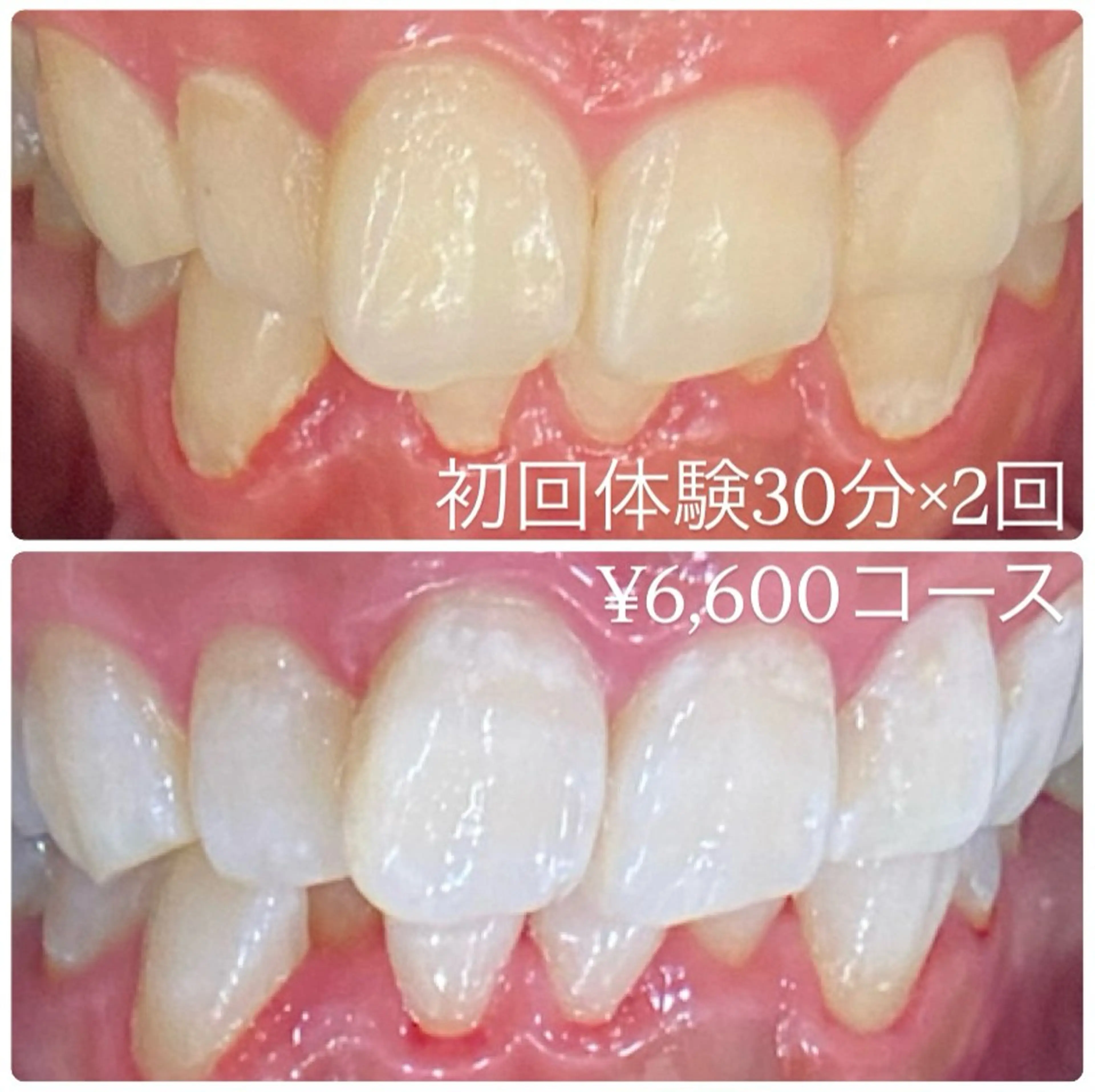 PLATINUM Beauty 横浜店所属・ホワイトニングルーム 横浜店のその他イメージ