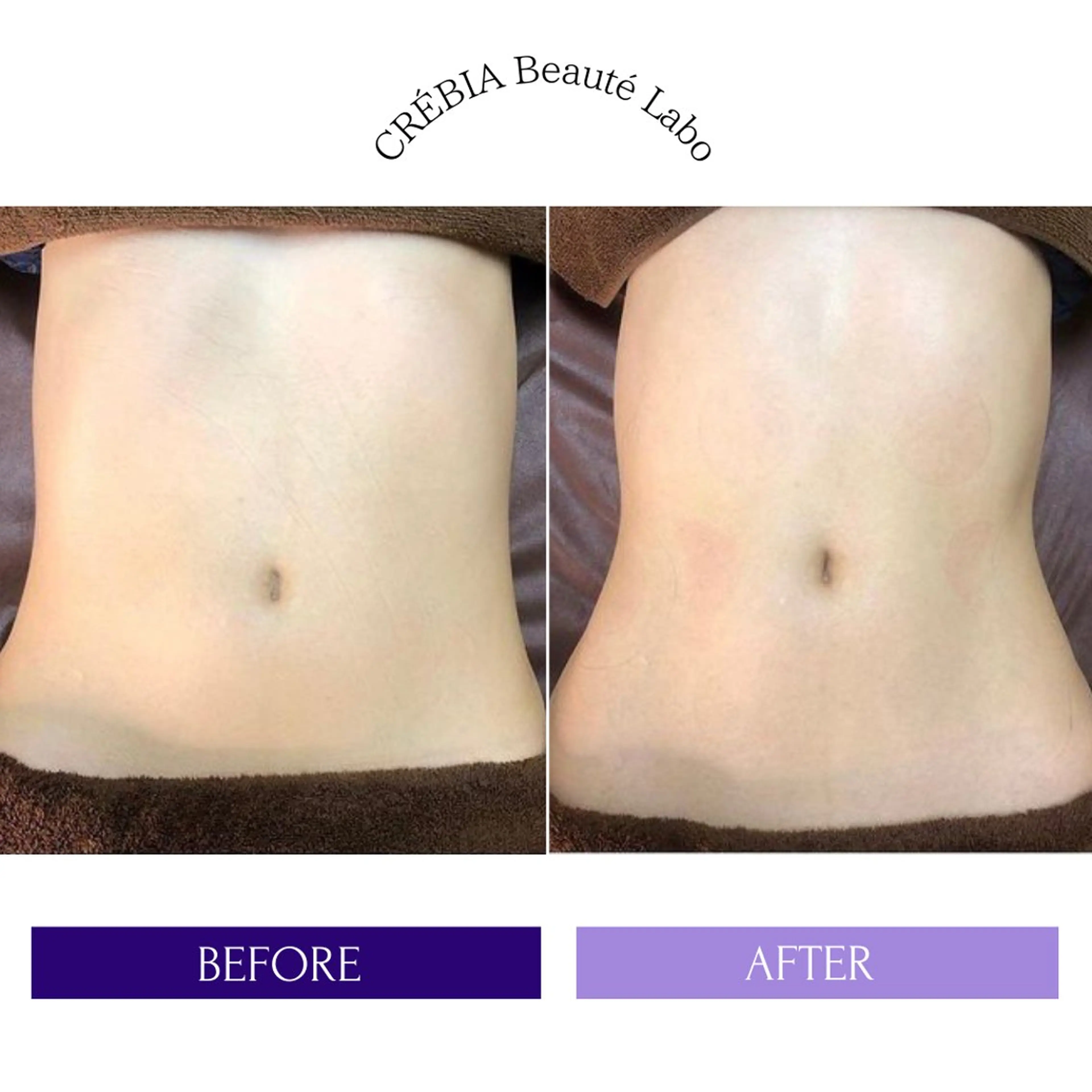 エステ リラク 小顔＆まつ毛サロン AKANE❤️のエステ・リラクイメージ