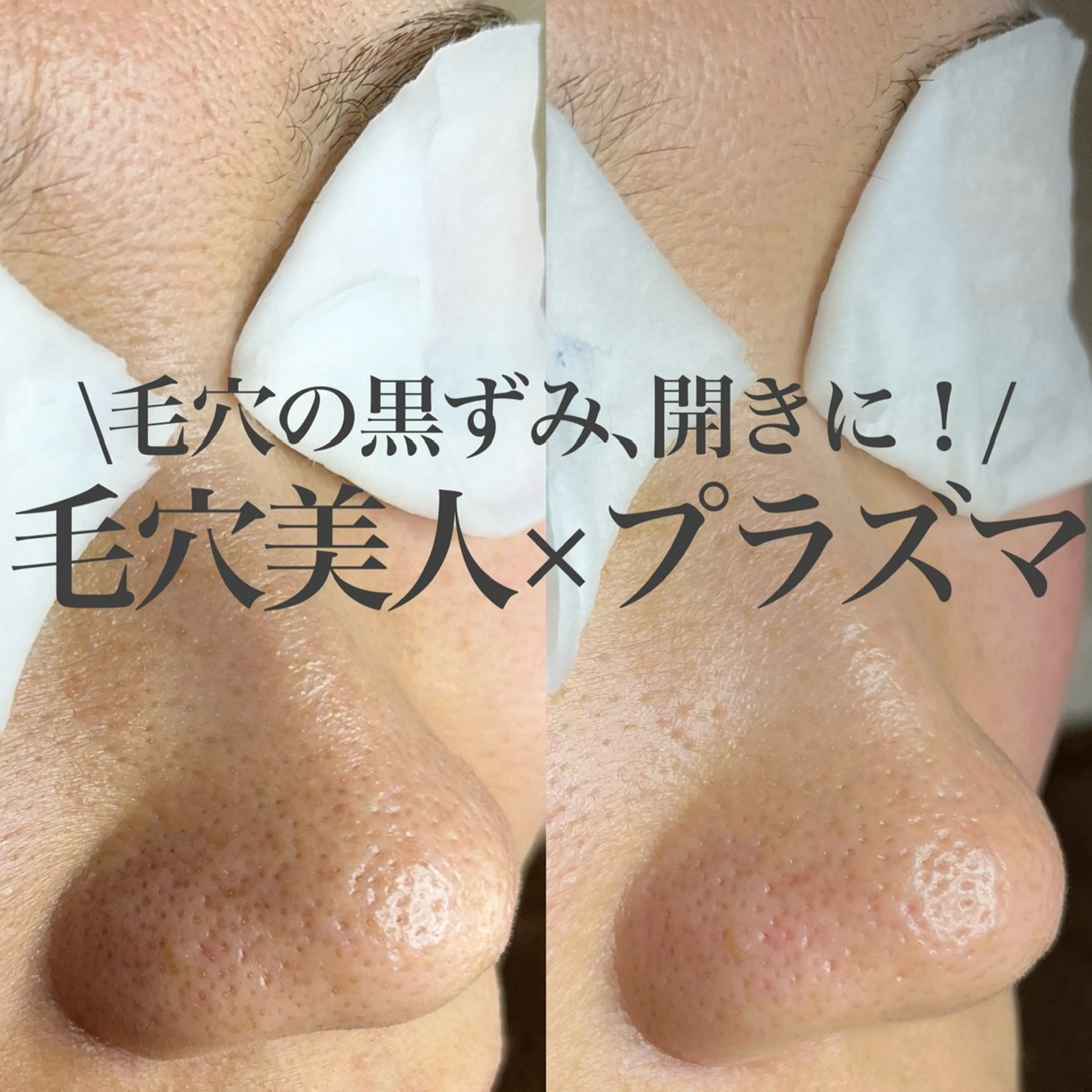 エステ 槙谷 あさみのエステ・リラクイメージ