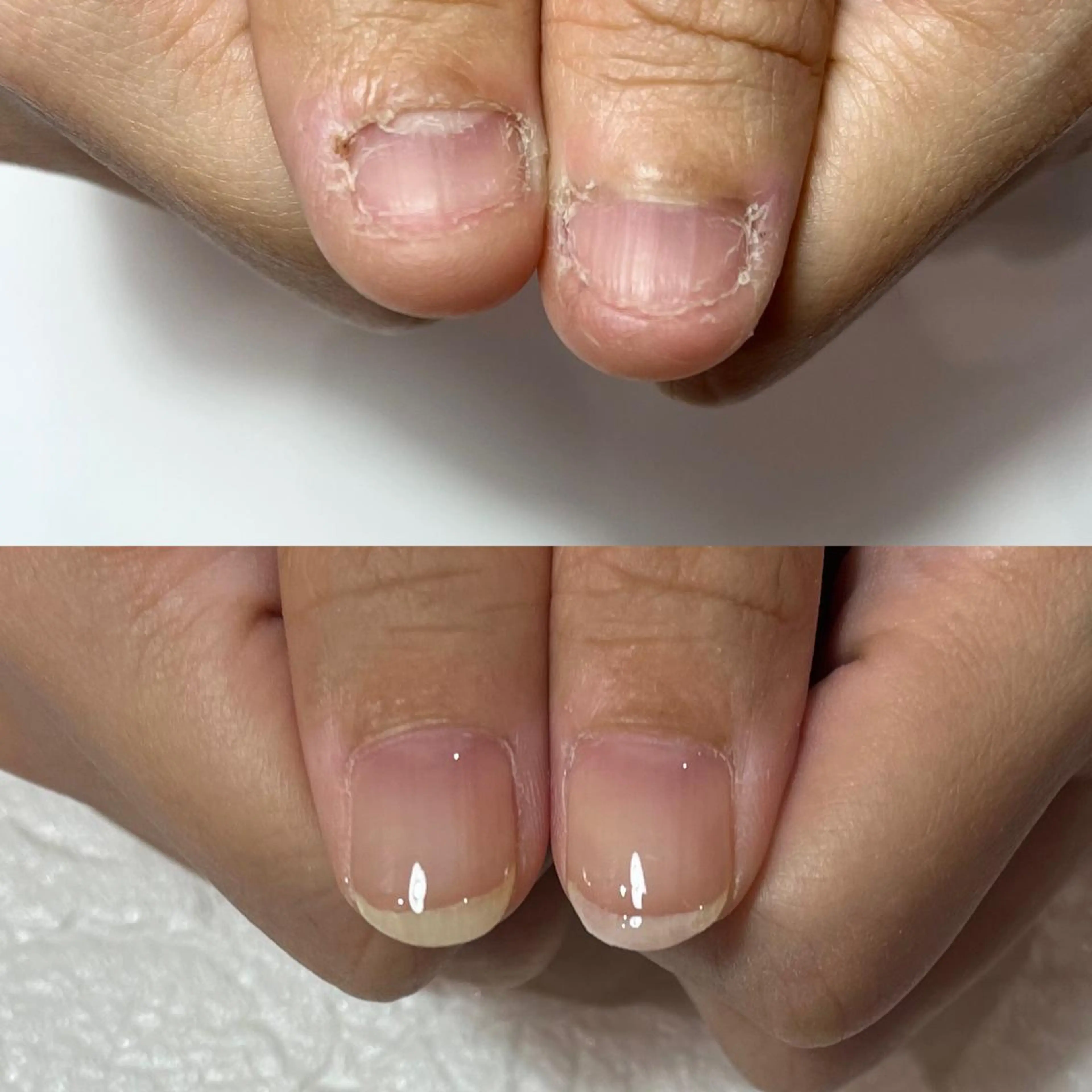 ネイル アートネイル クリアネイル ジェルネイル パラジェル 自爪育成・巻き爪 補正講師　津蔵のネイルデザイン