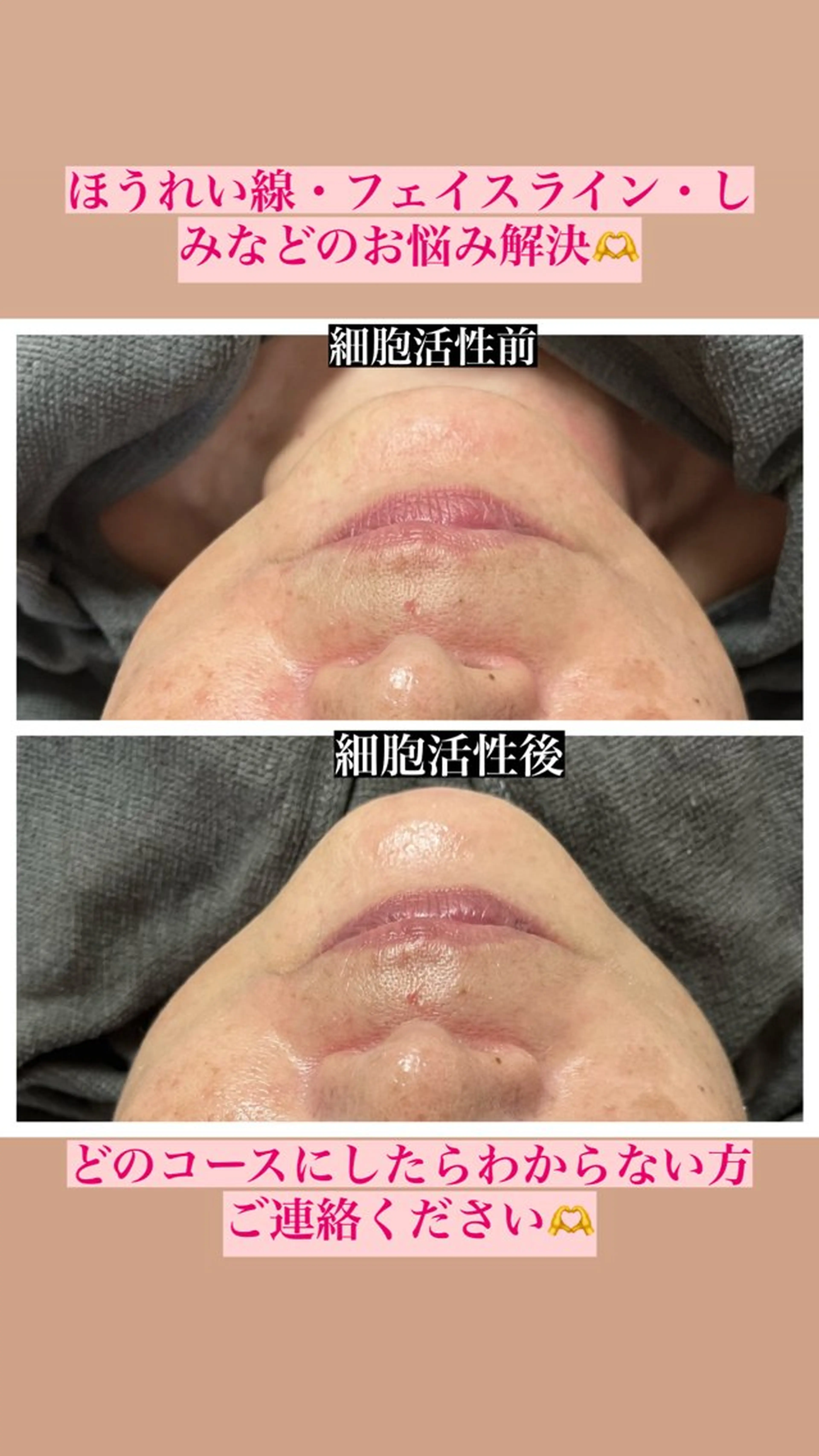 エステ perky所属・perky 羽島のマツエク・マツパデザイン