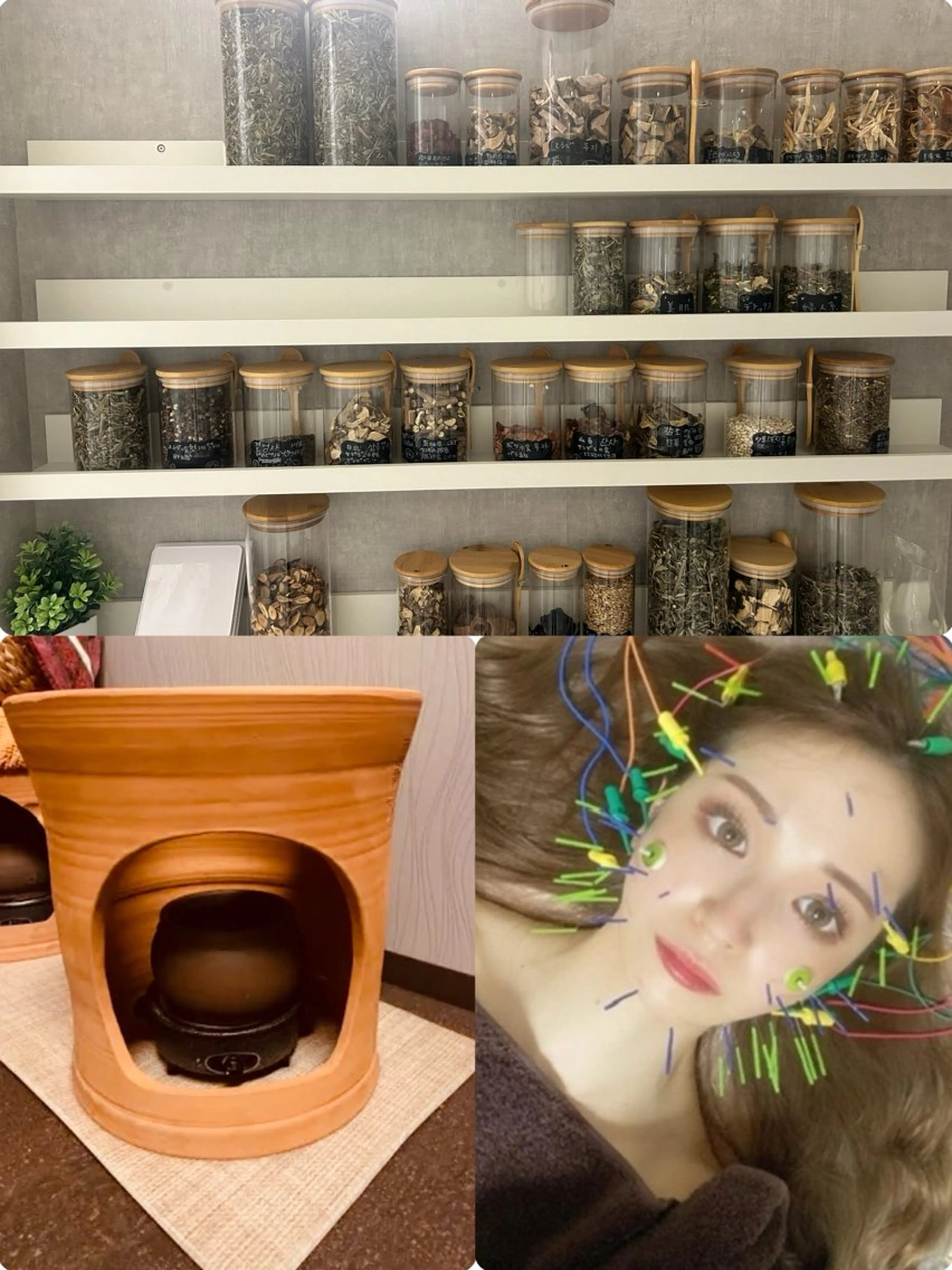 本日限定価格！黄土よもぎ人気NO.3【黄土よもぎ蒸し🌿＋美容鍼】毛穴から老廃物を出してデト、艶肌&小顔、むくみ改善の写真