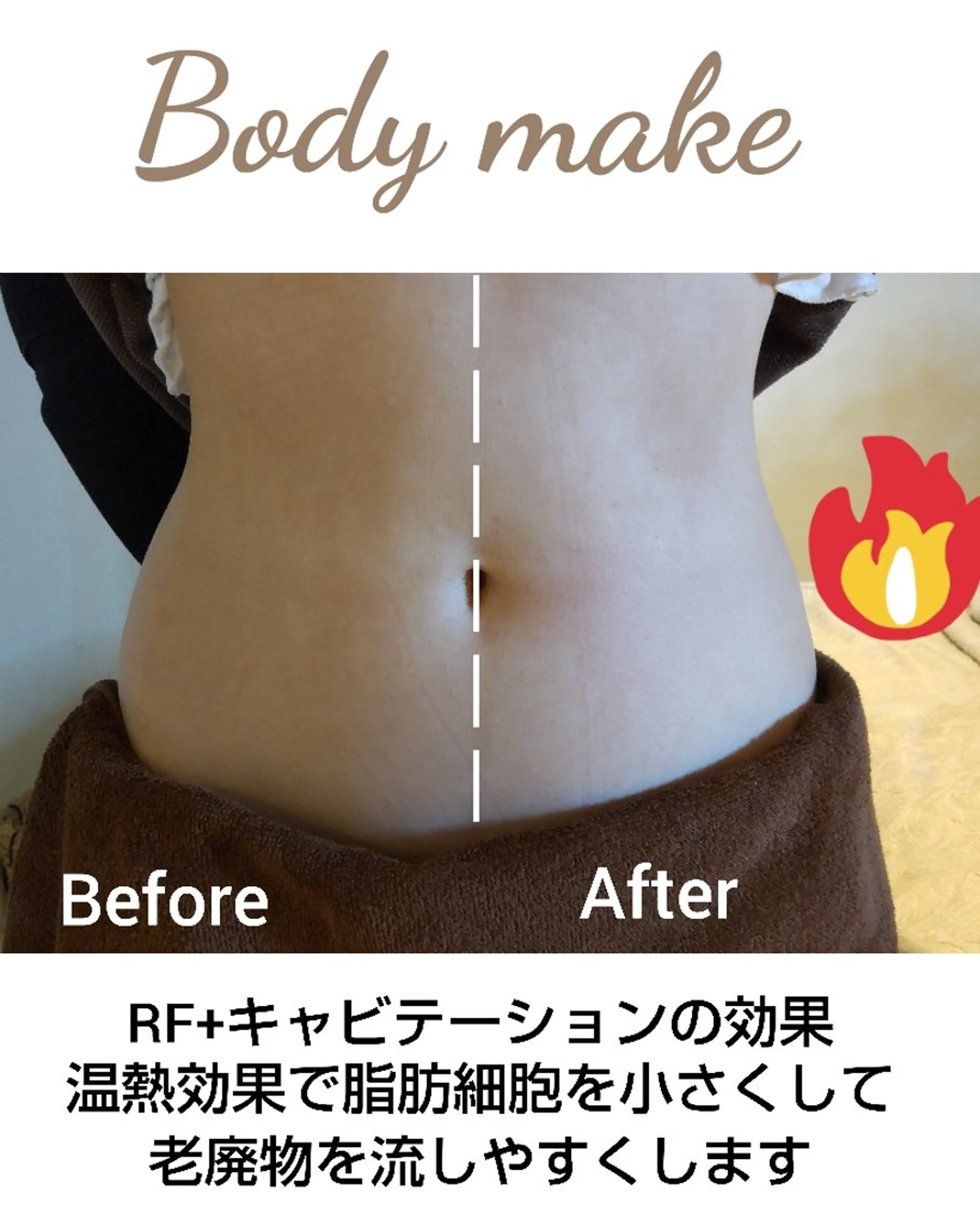 角質・毛穴洗浄🌼 脱毛🌸嶋津弘美のエステ・リラクイメージ