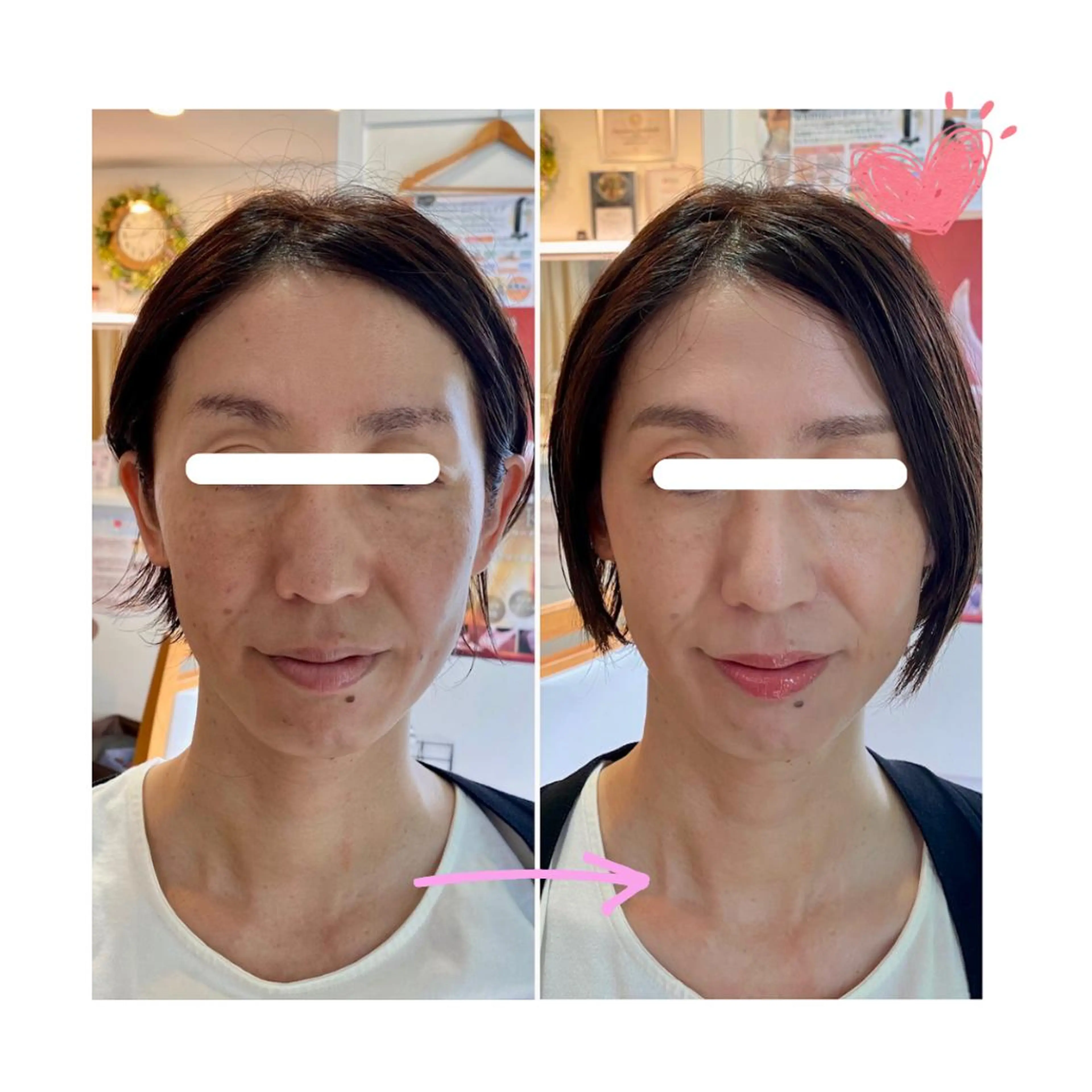 その他 美肌専門サロン かれんのエステ・リラクイメージ