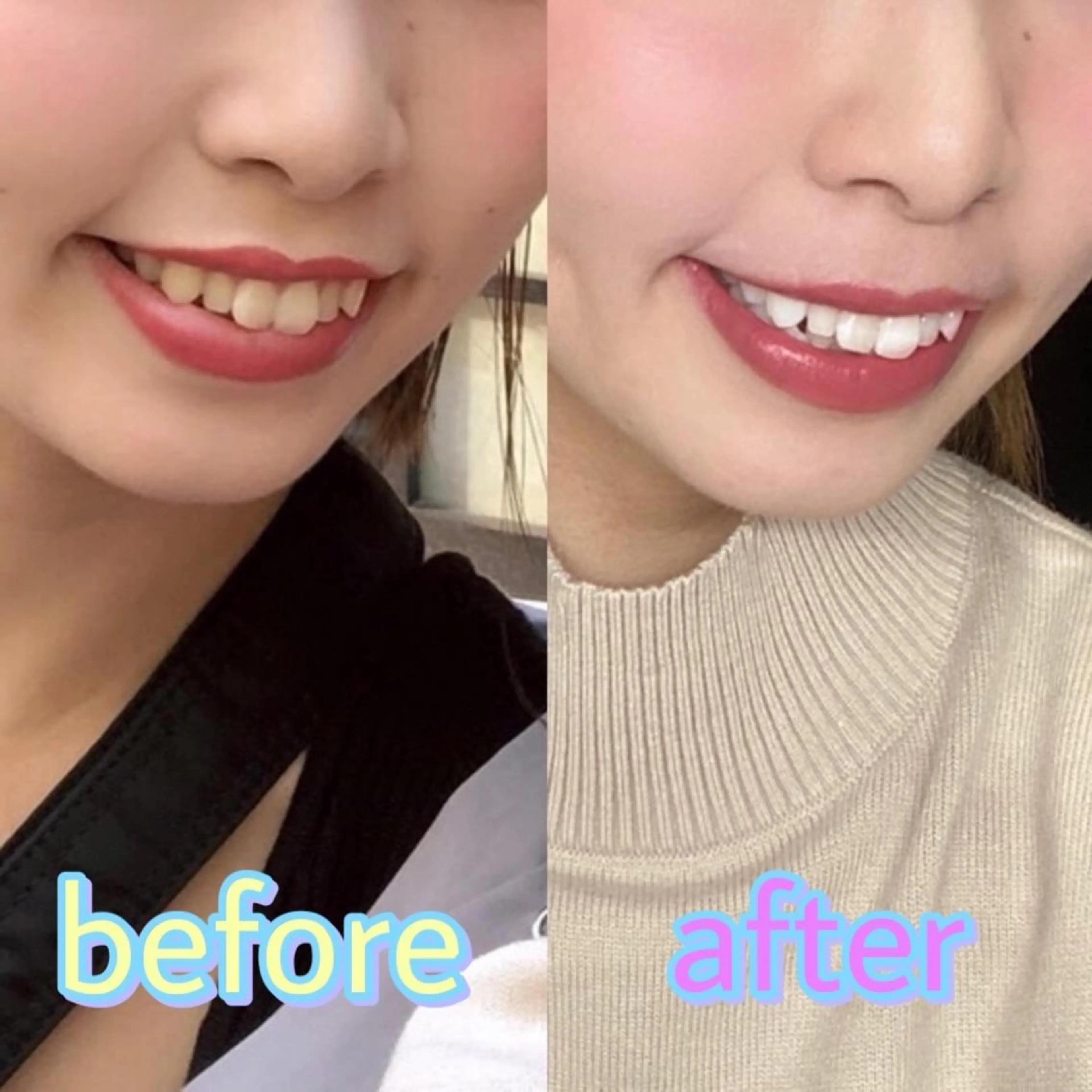 ホワイトニング専門店 LCS 汐留店 森田のその他イメージ