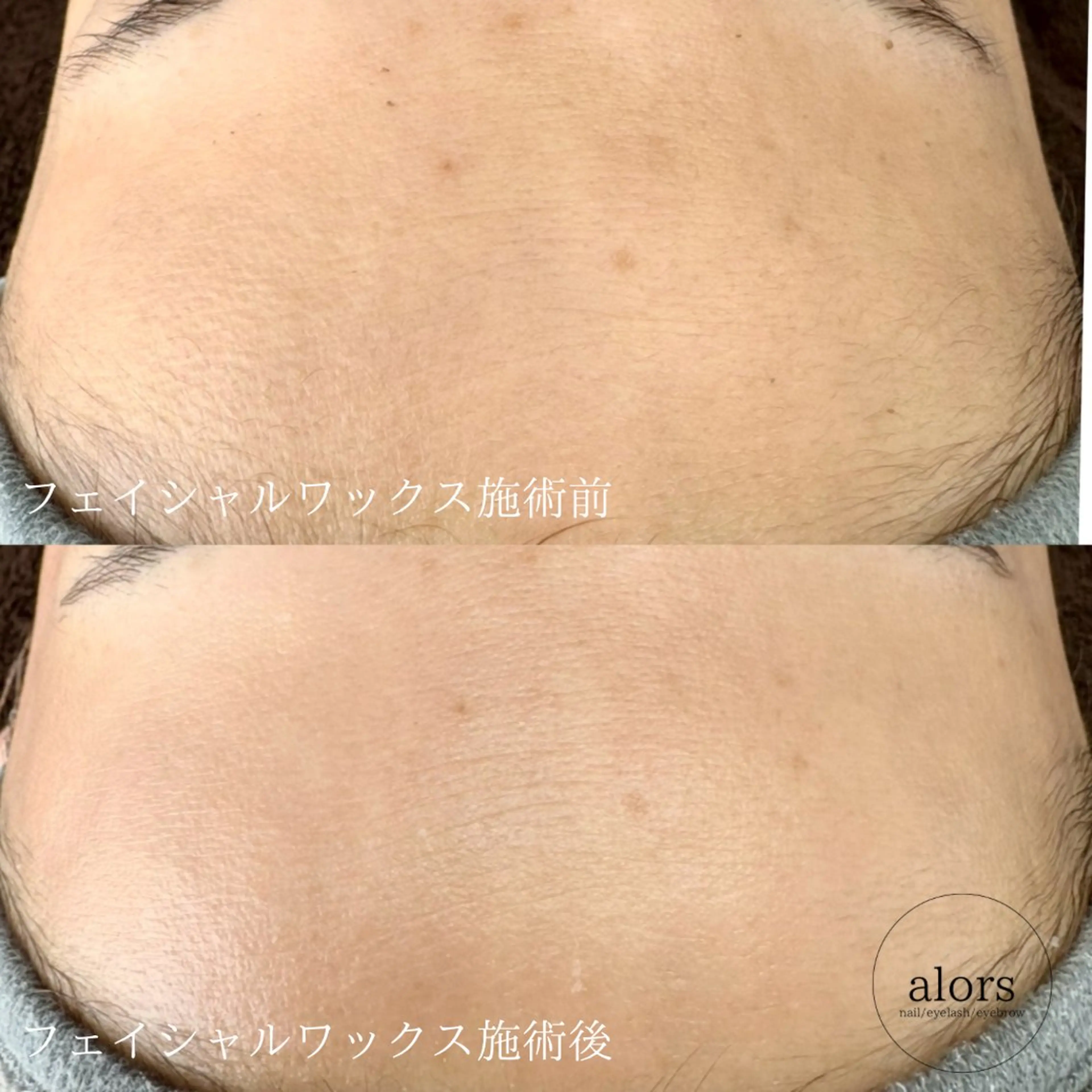 alors所属・alors shimoのマツエク・マツパデザイン