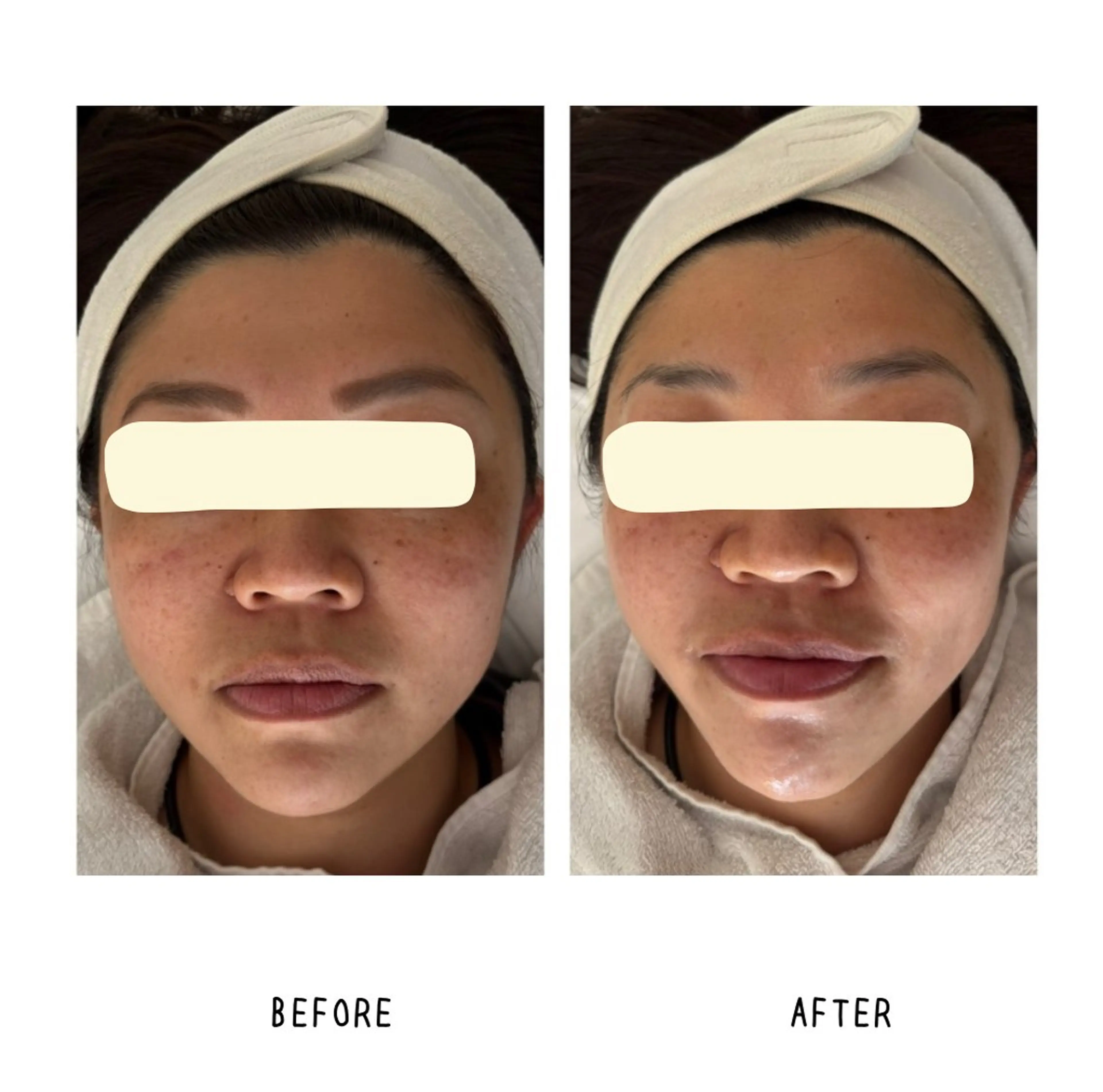 grow所属・Yoshino Erinaのエステ・リラクイメージ