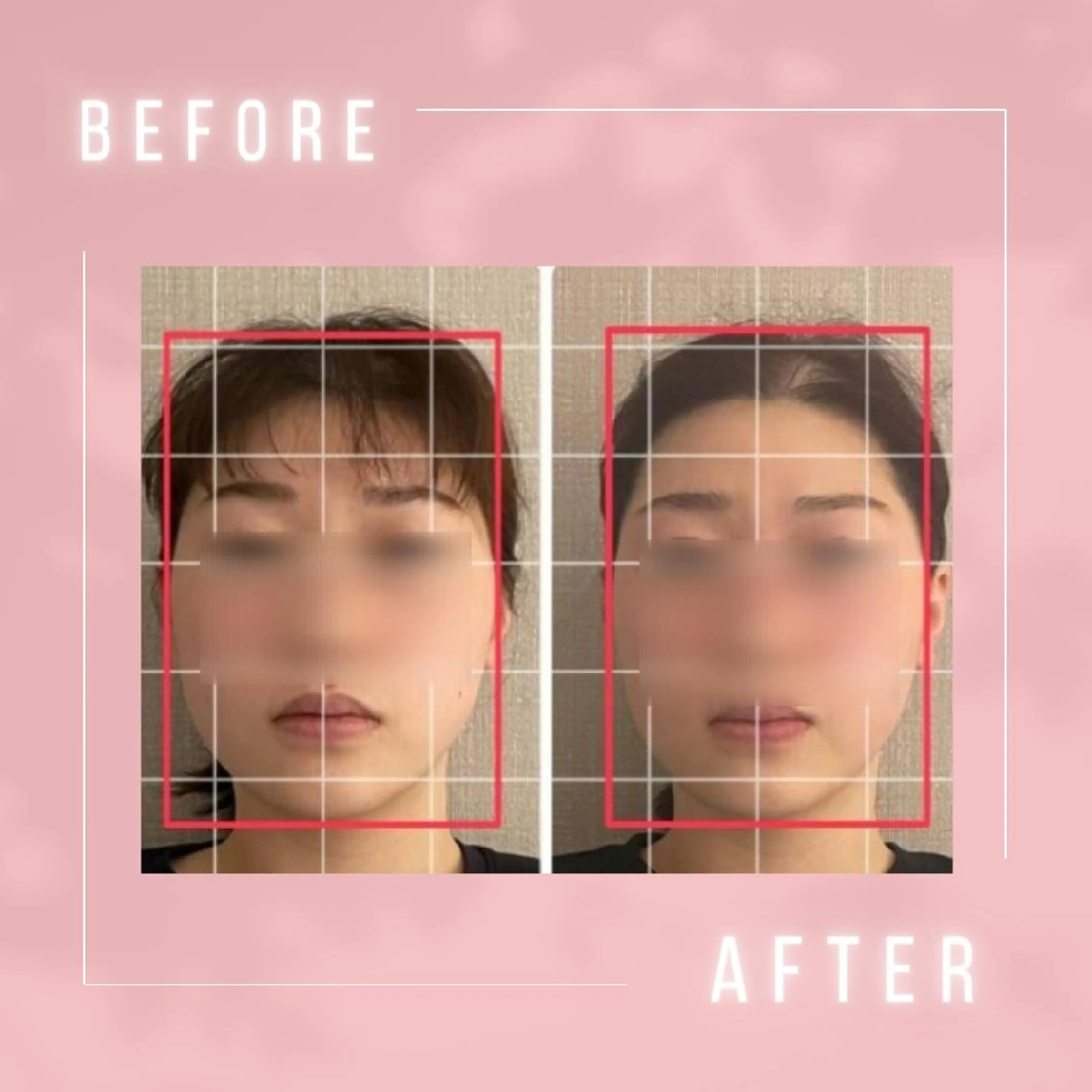 小顔・肌悩み専門店 ボーテドリッシュのエステ・リラクイメージ