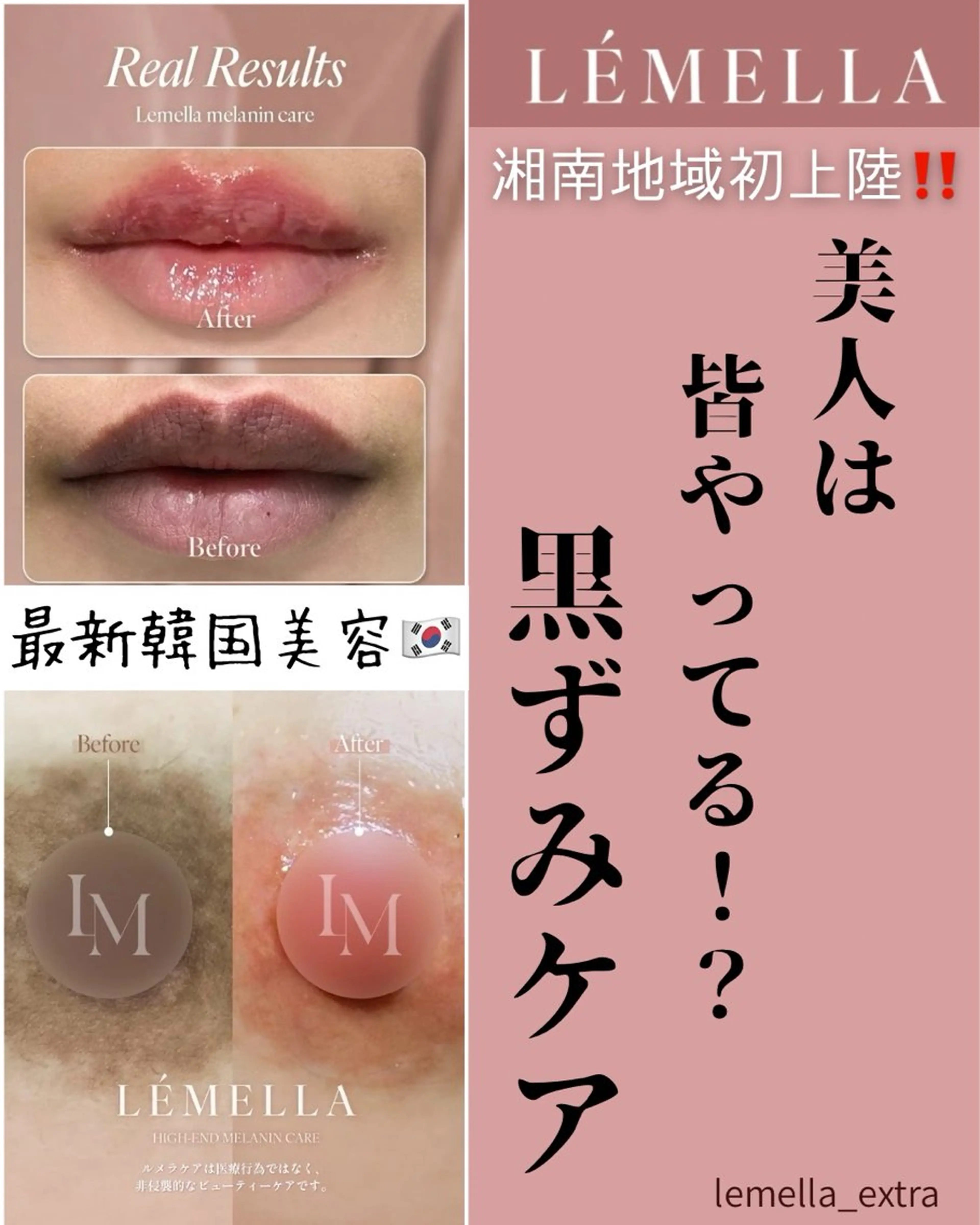 その他 extranails ／lemellaのネイルデザイン