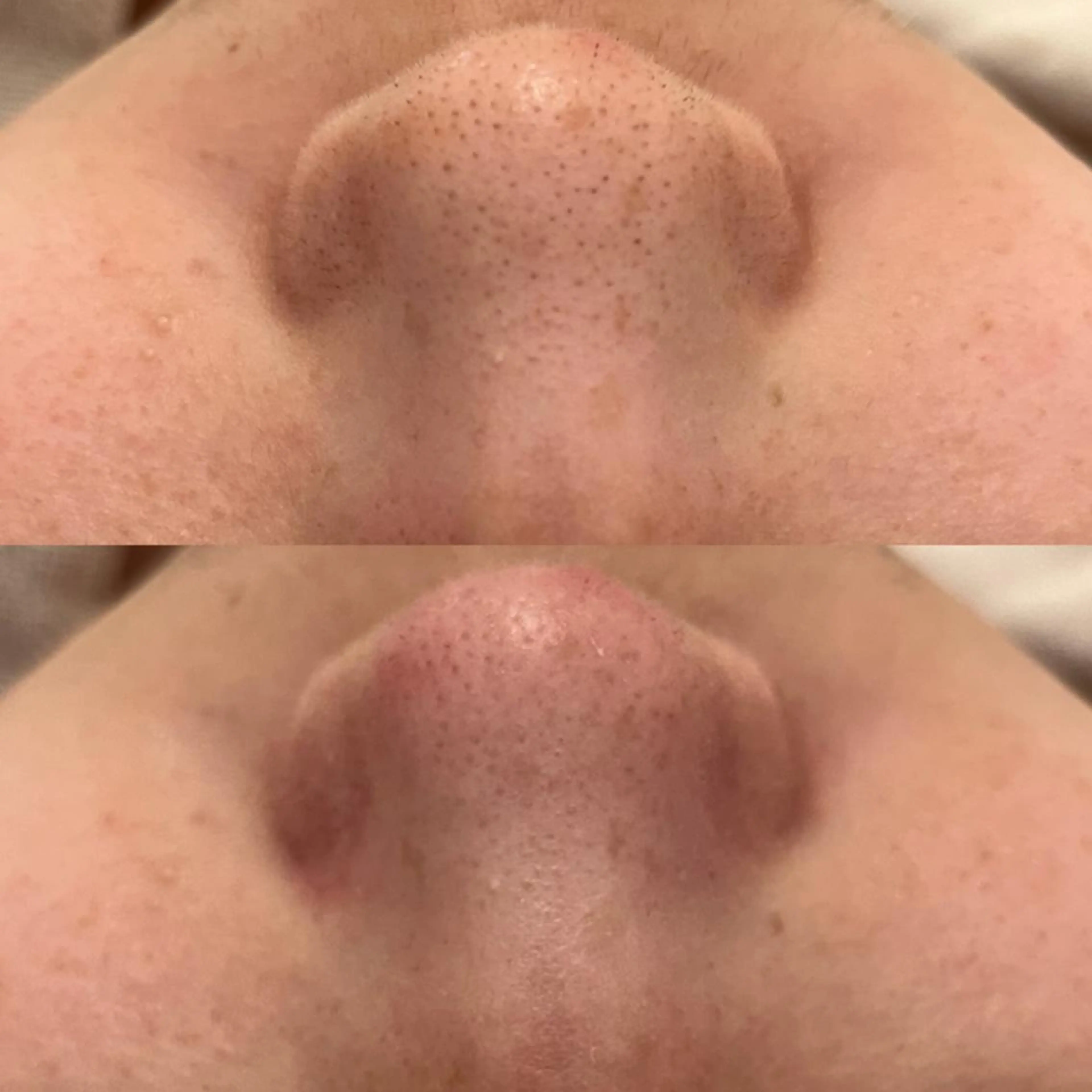 エステ ✨美肌水光✨ アトリエリュバンのエステ・リラクイメージ