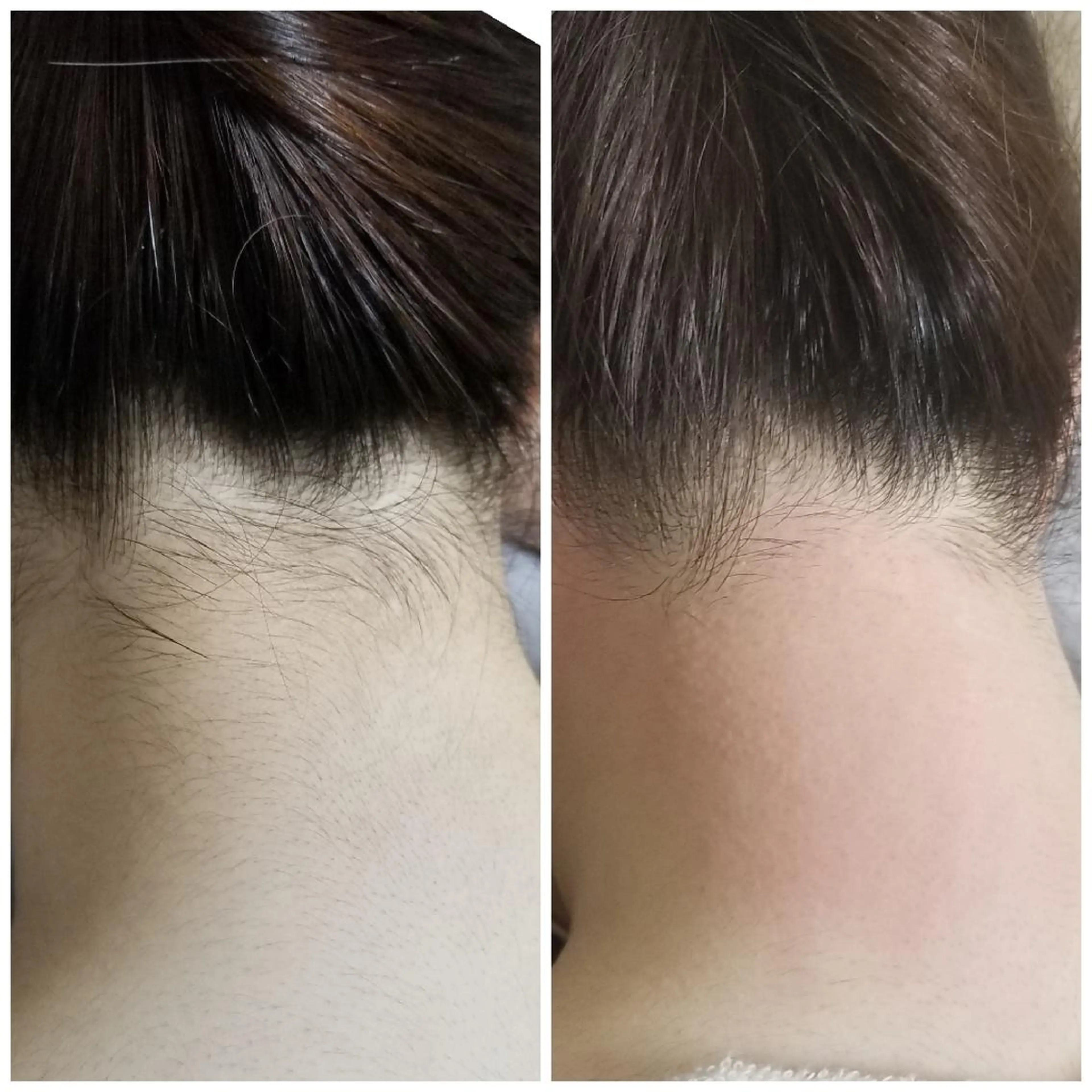 A*[エースター] シュガーリング🍋のエステ・リラクイメージ