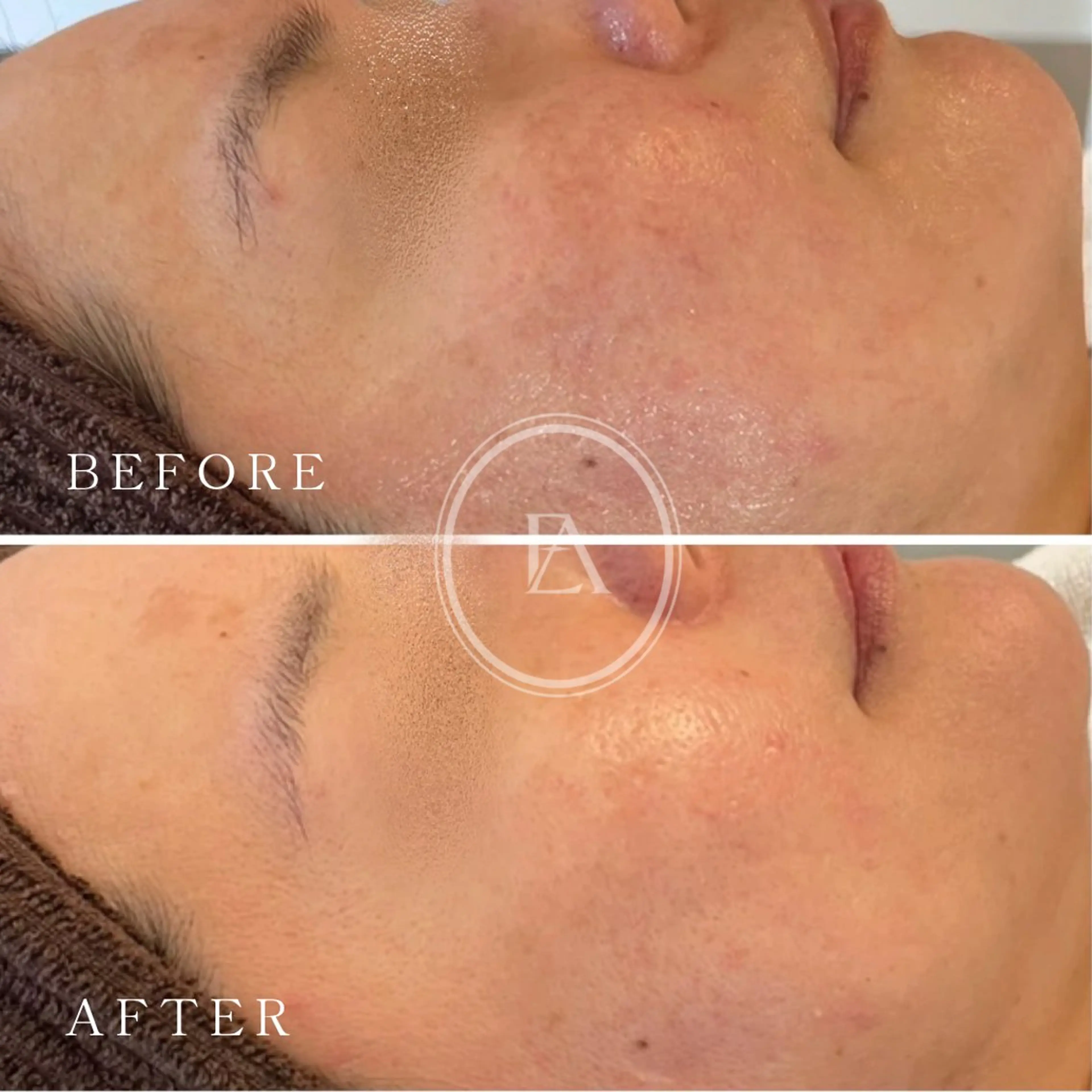 エステ エストリア 所沢店のエステ・リラクイメージ