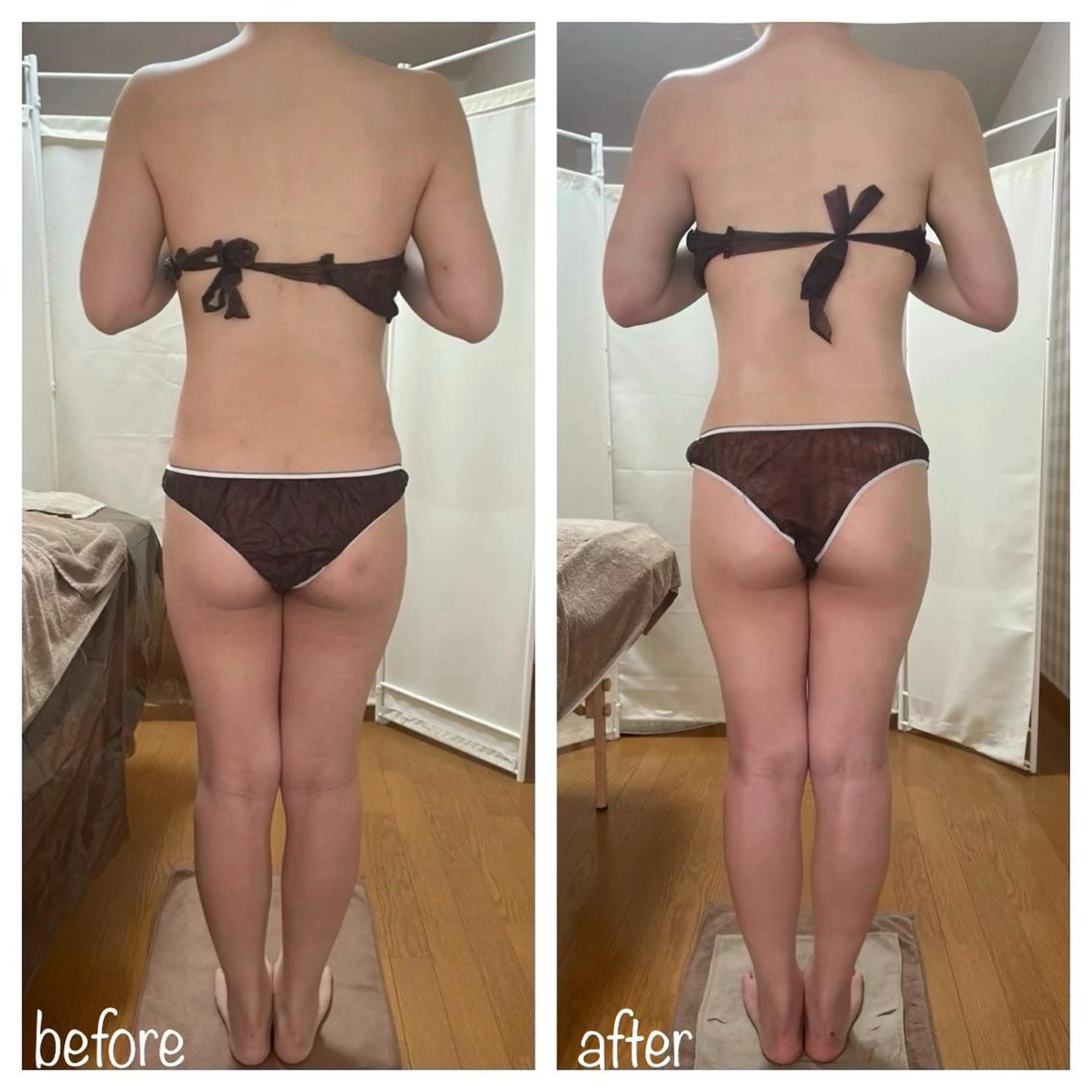 biloop所属・《痩身×疲労改善》 BILOOPのエステ・リラクイメージ