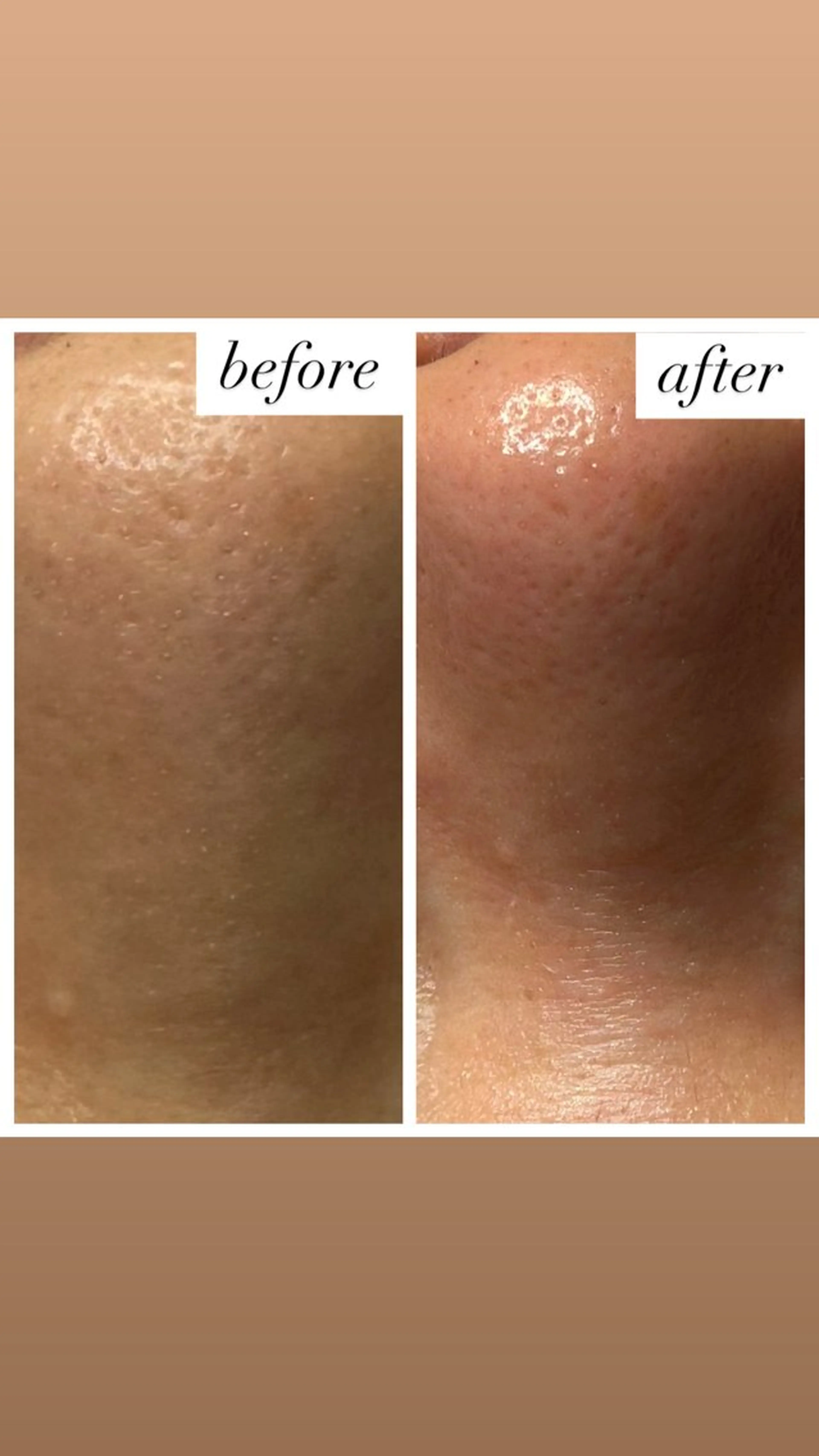 チュルん♡毛穴ケアフェイシャル【40分】の写真