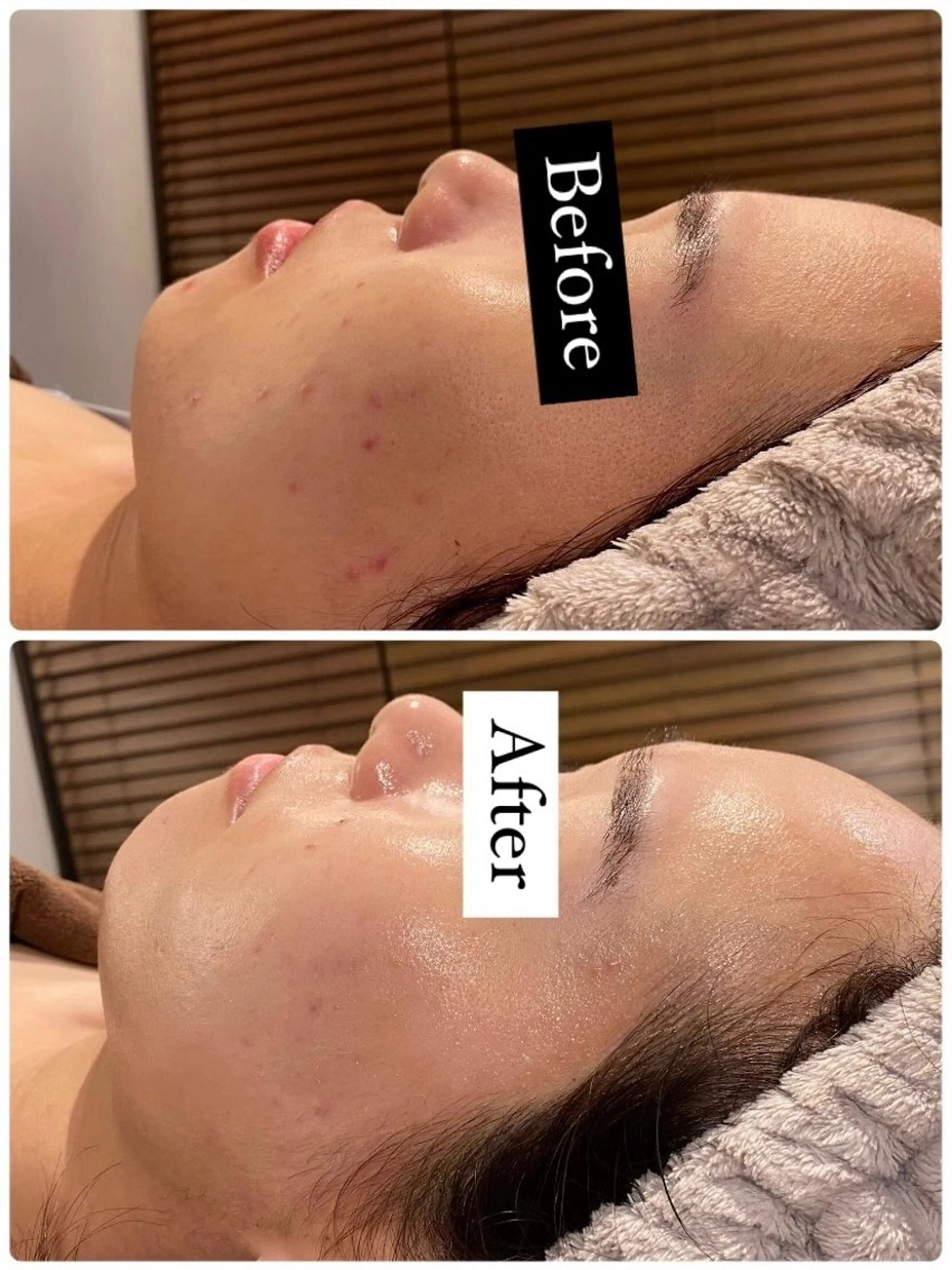 エステ リラク ホワイトニング ショップ吉祥寺2号店のその他イメージ