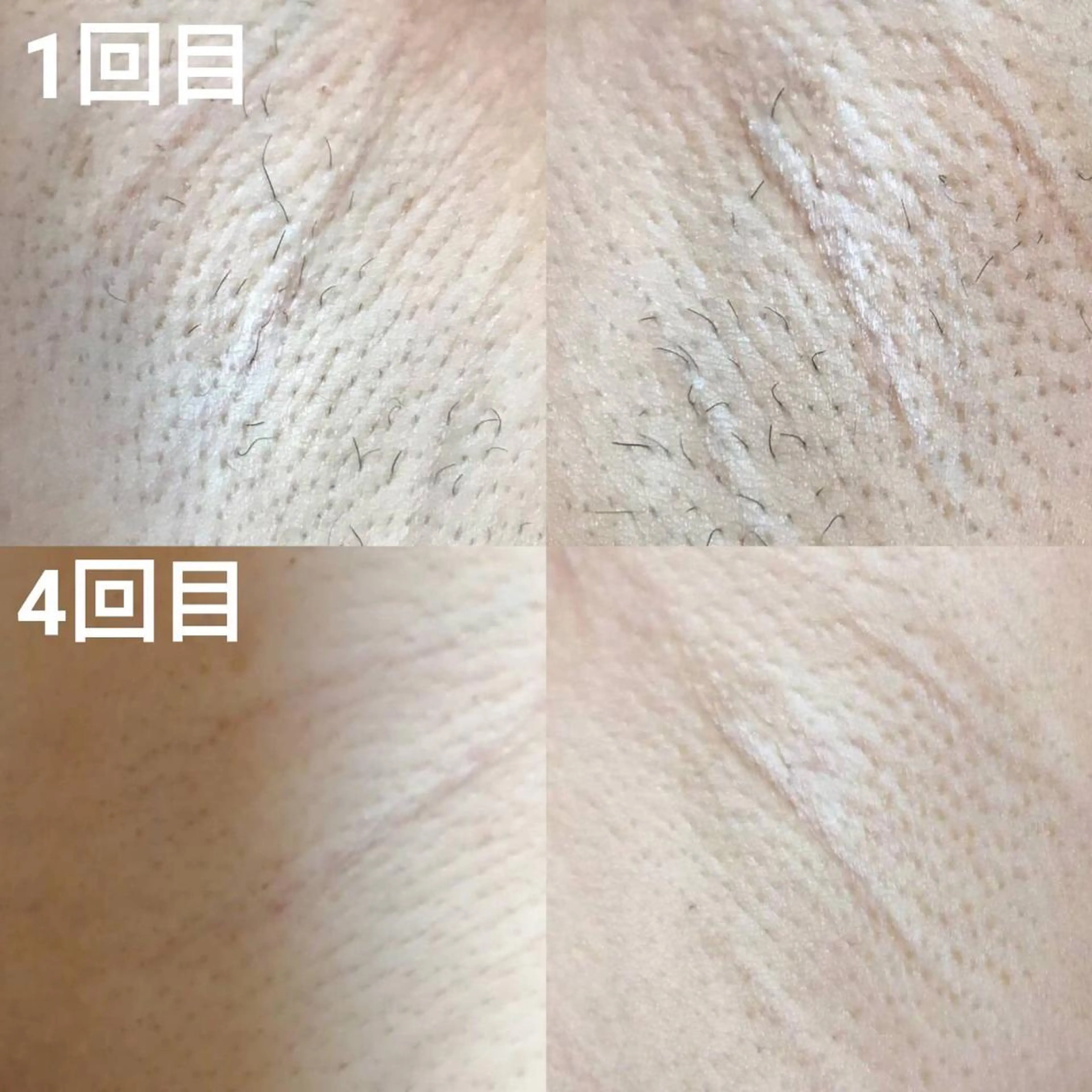 メンズ キッズ 男女同額完全個室脱毛 LEPIA内田のエステ・リラクイメージ