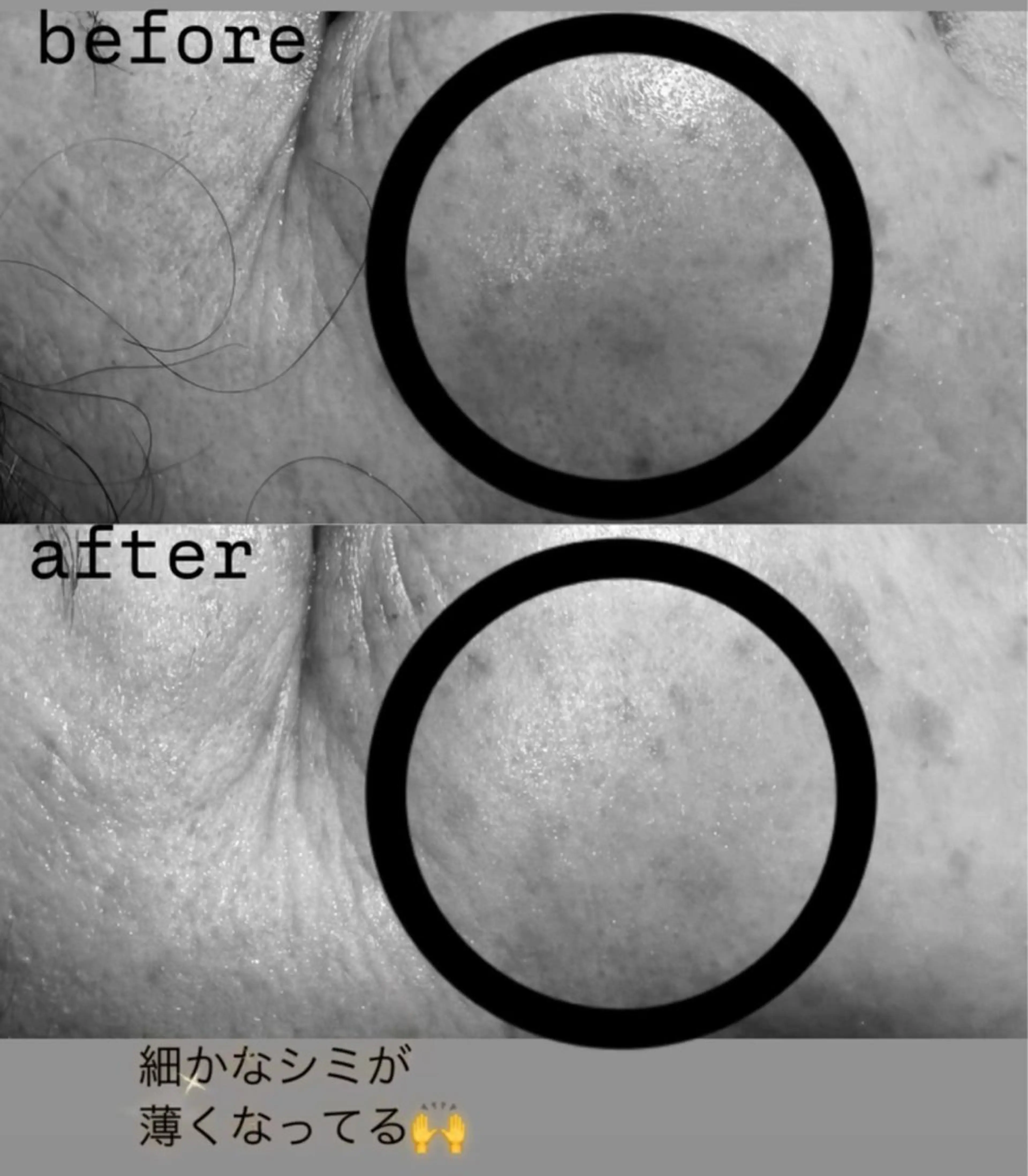 【2回目以降】💪🏻❤️‍🔥⋆͛剥離しないエイジングケア✩.*˚の写真