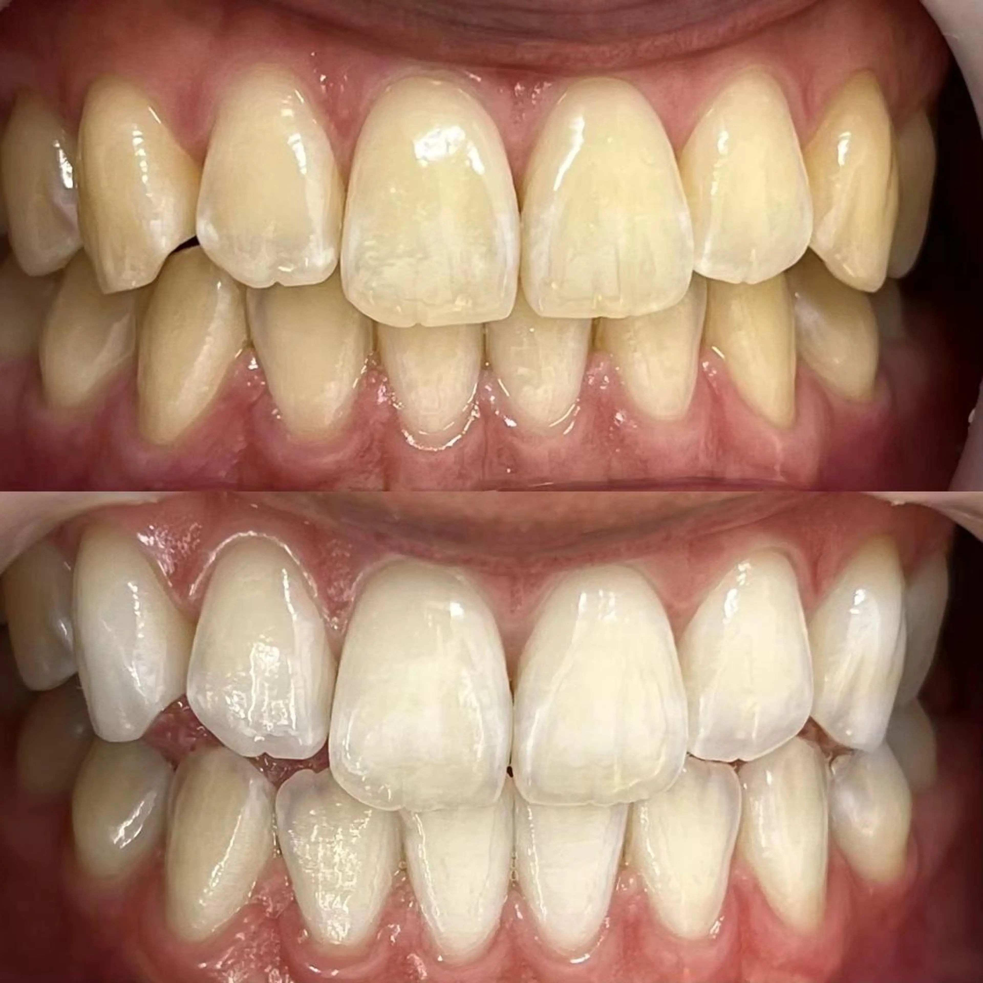 LBSホワイトニング 銀座店💎公式のその他イメージ