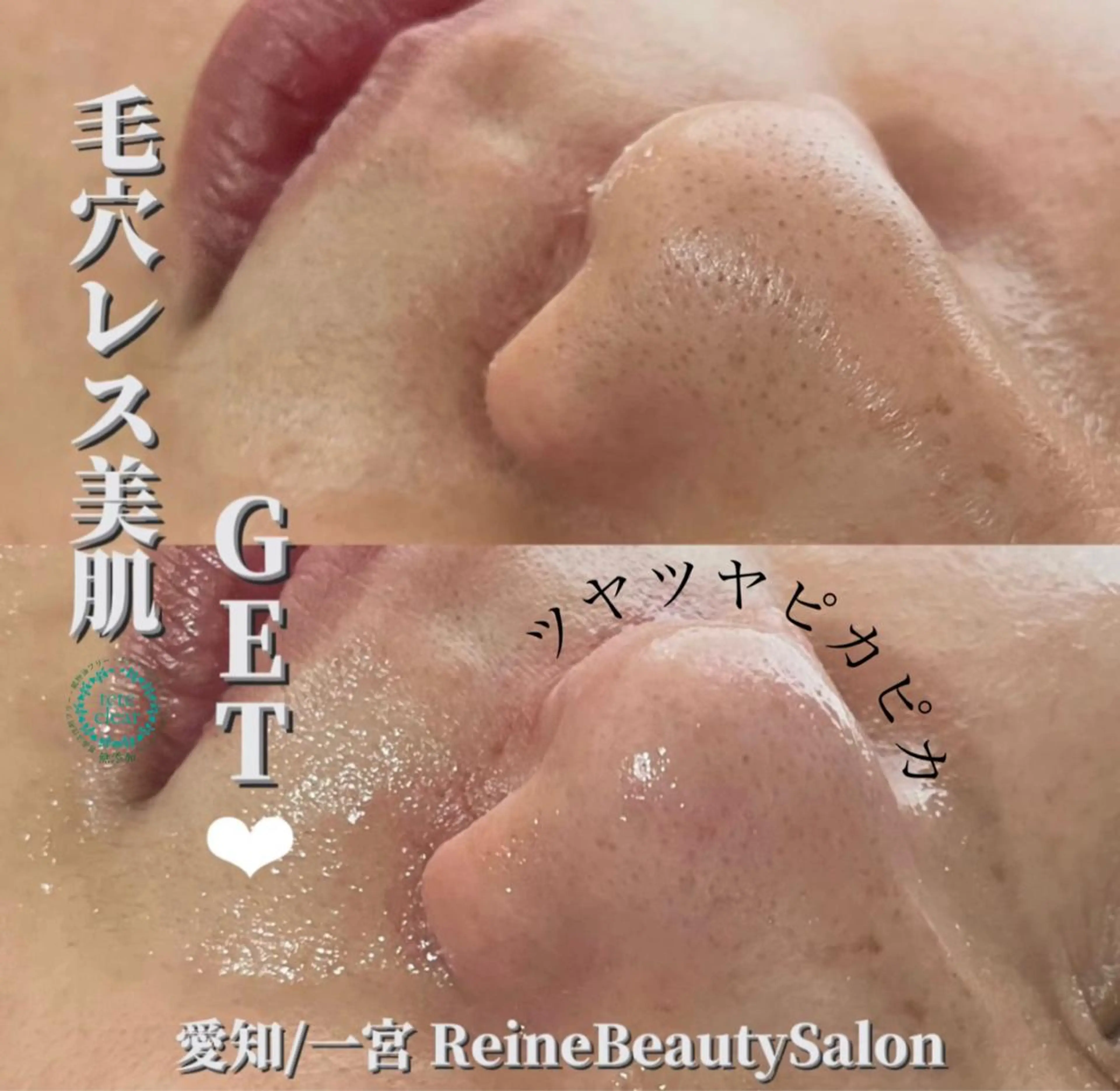 エステ Reine BeautySalon所属・毛穴/シミ肝斑/脱毛 横山梨里のエステ・リラクイメージ