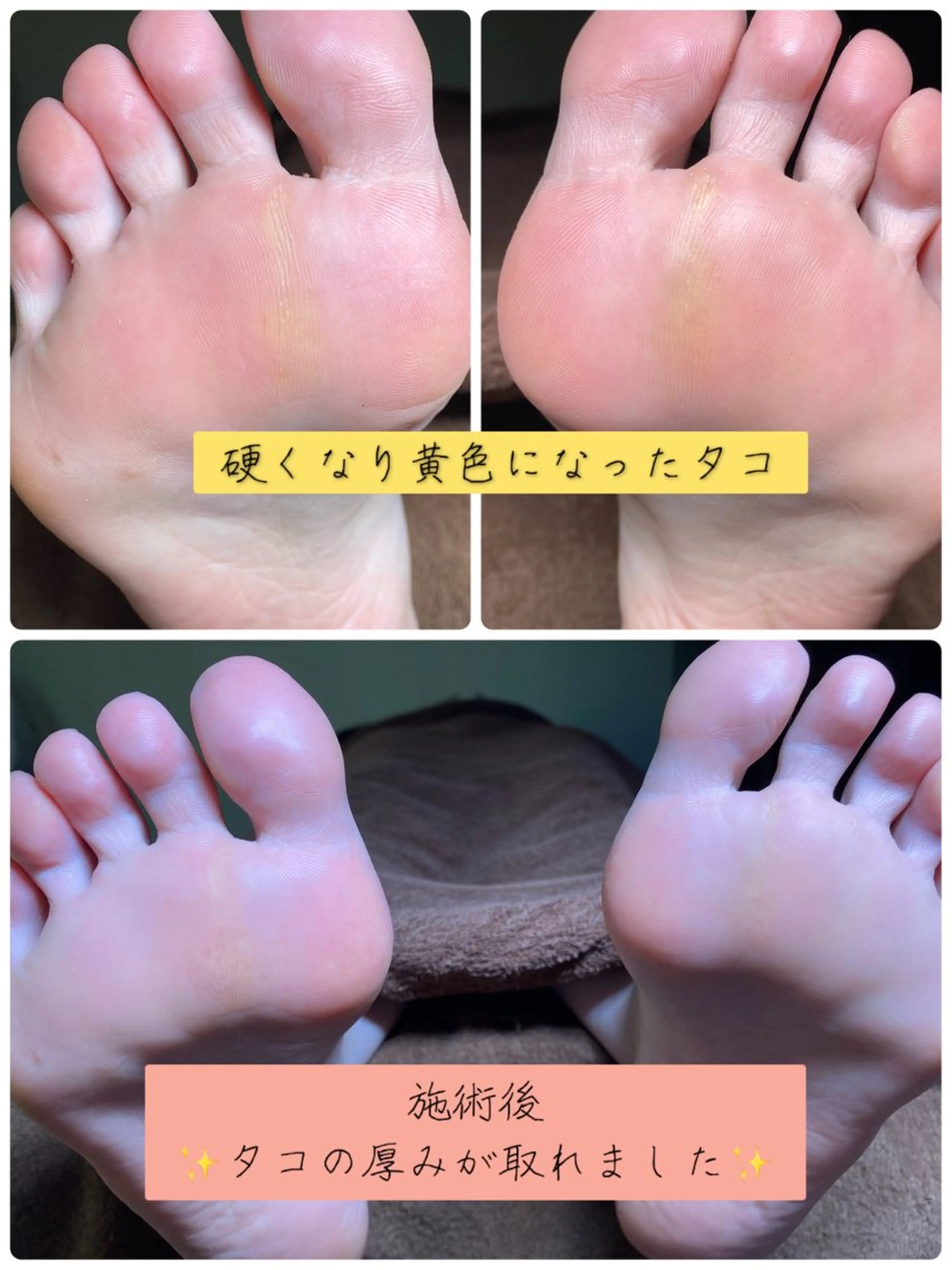 ネイル フットネイル 黄色 フットネイル Studio Jivanのネイルデザイン