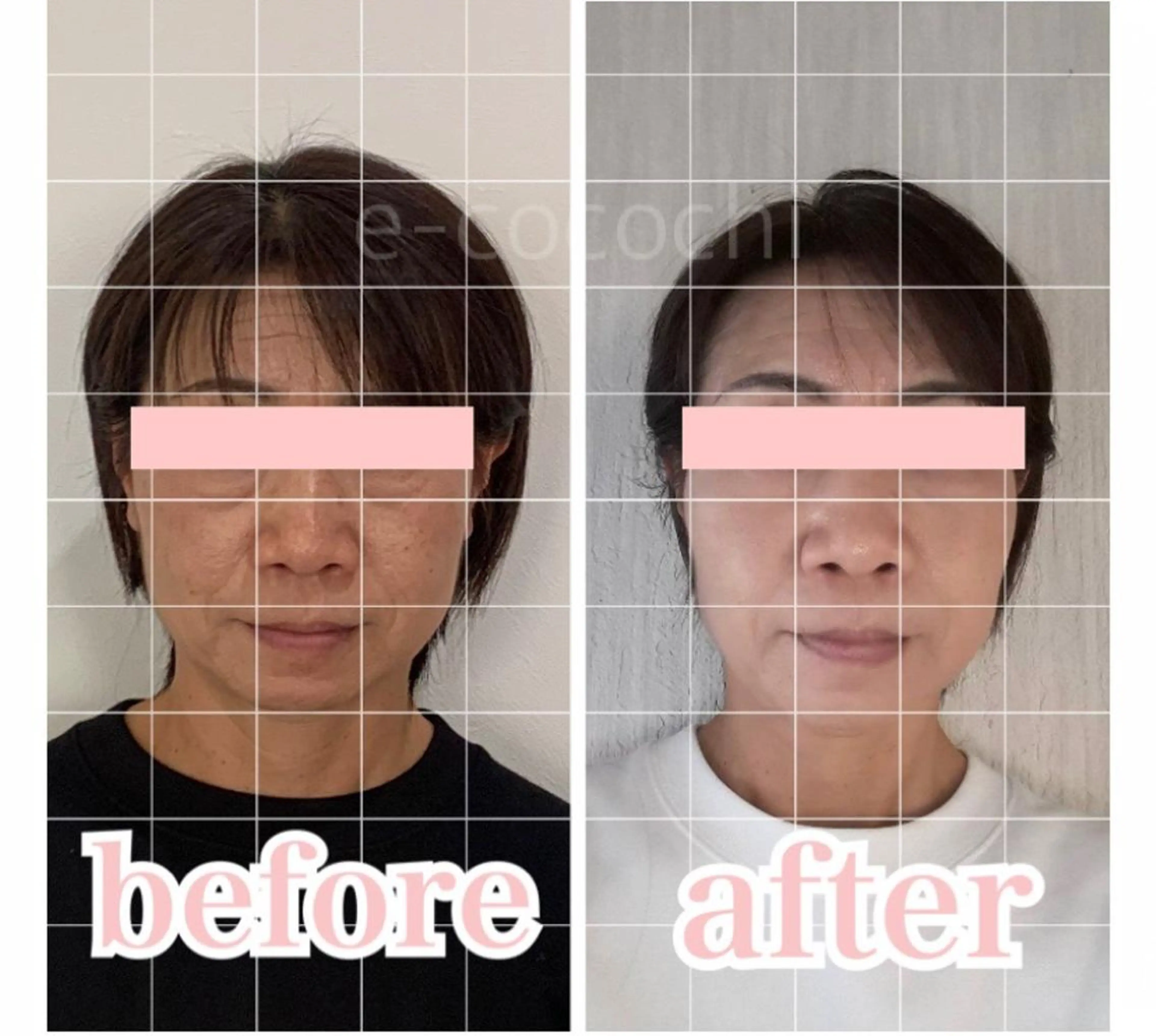 小顔と ヘッドスパのお店のエステ・リラクイメージ