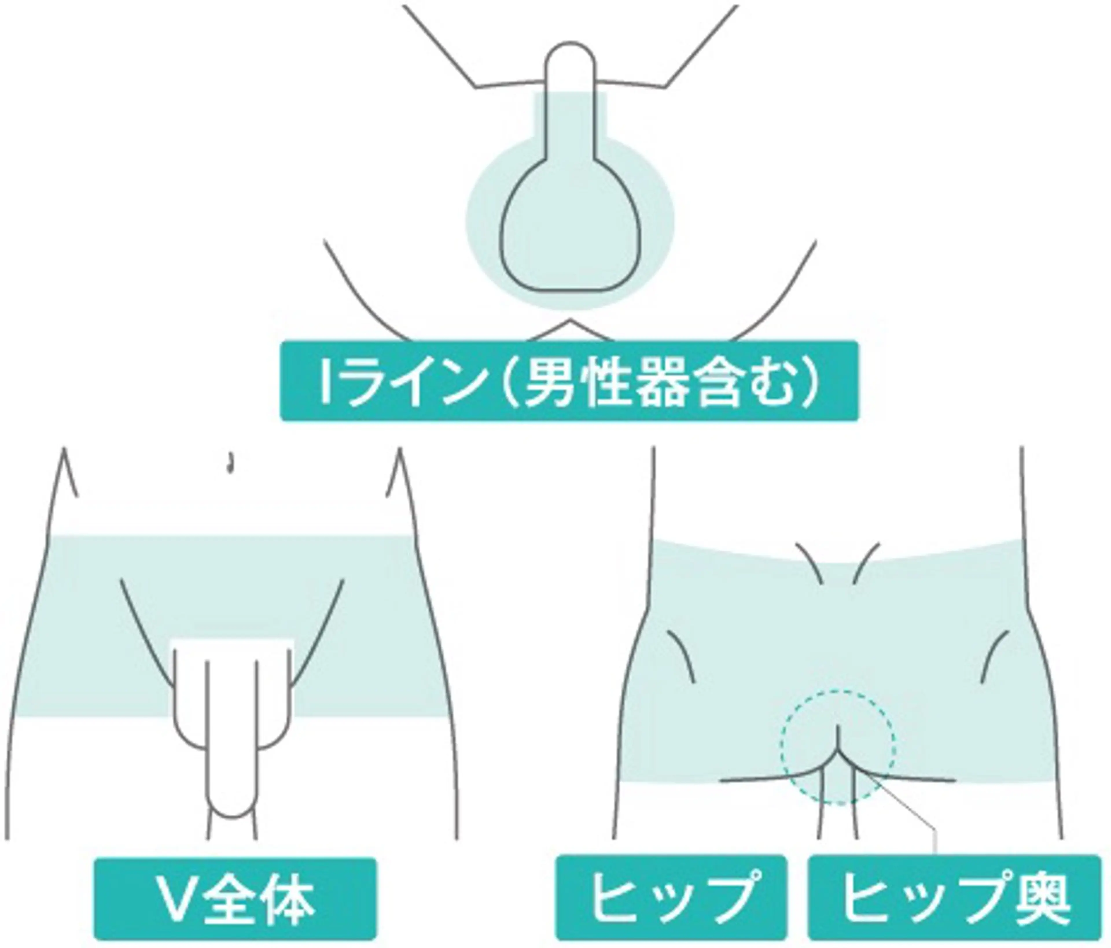 【初回限定】メンズ VIO脱毛の写真