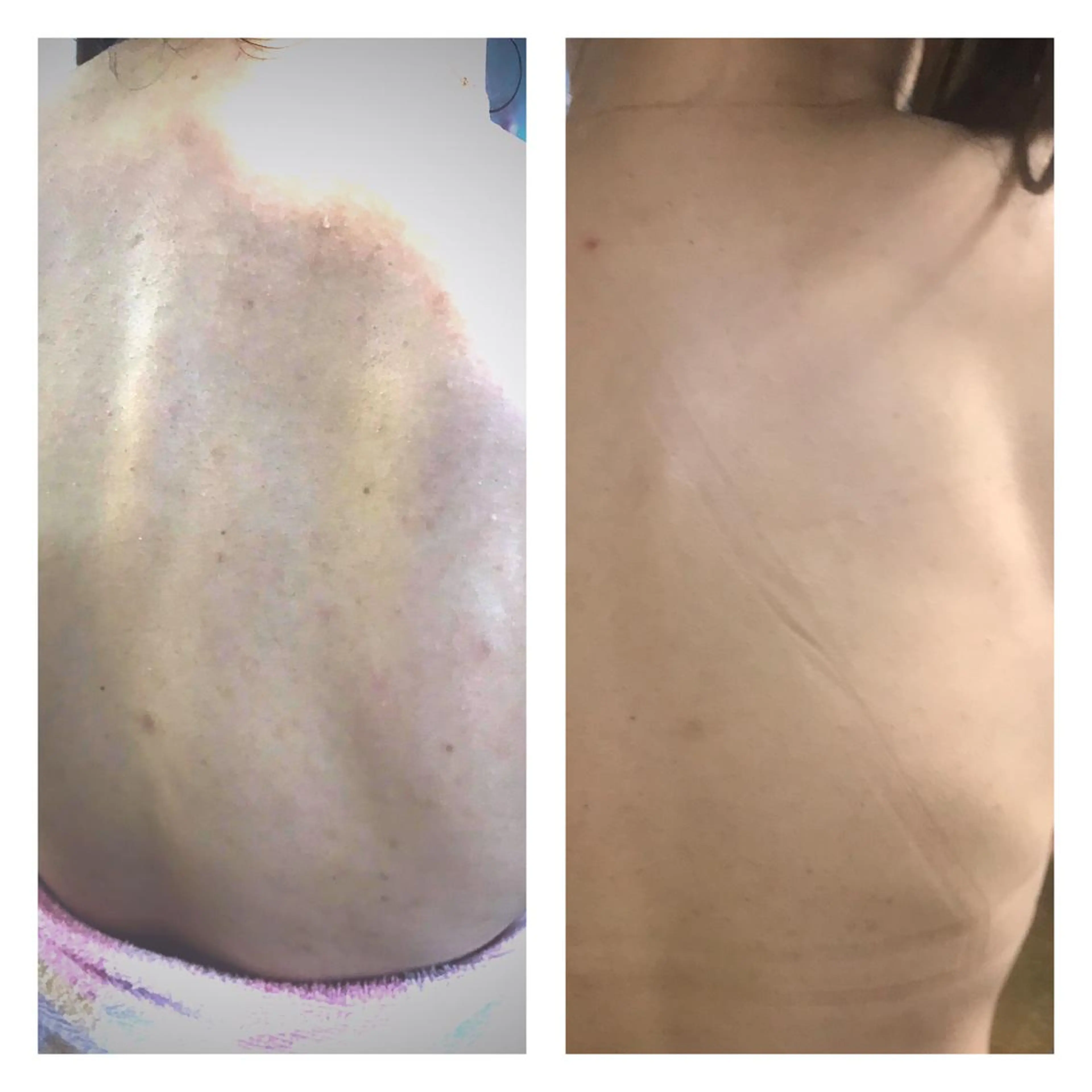 エステ 【足圧】鬼👹リンパ 身体整うサロンのエステ・リラクイメージ