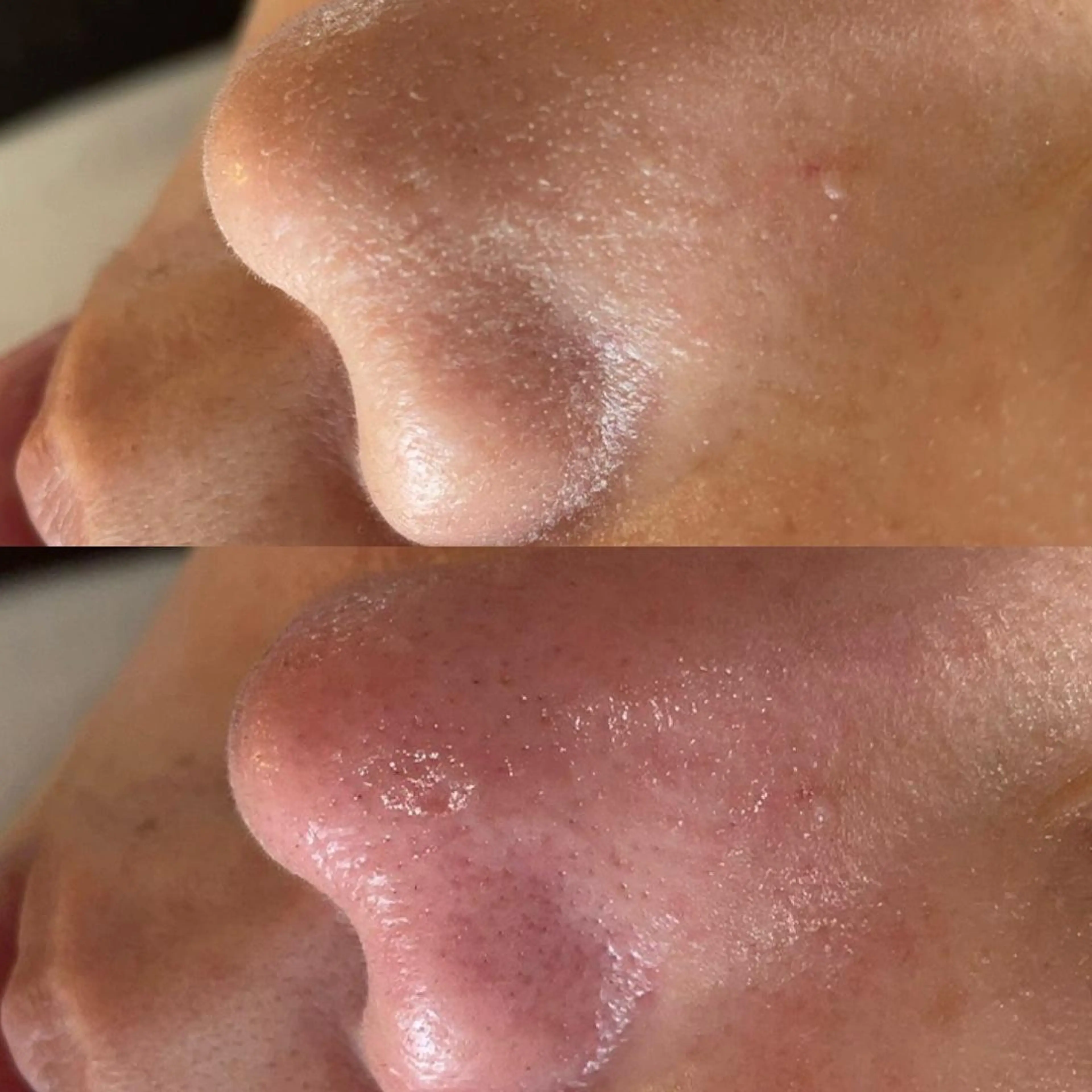 Amm所属・🏆艶肌ワックス🏆 ララピール✨Ammのエステ・リラクイメージ