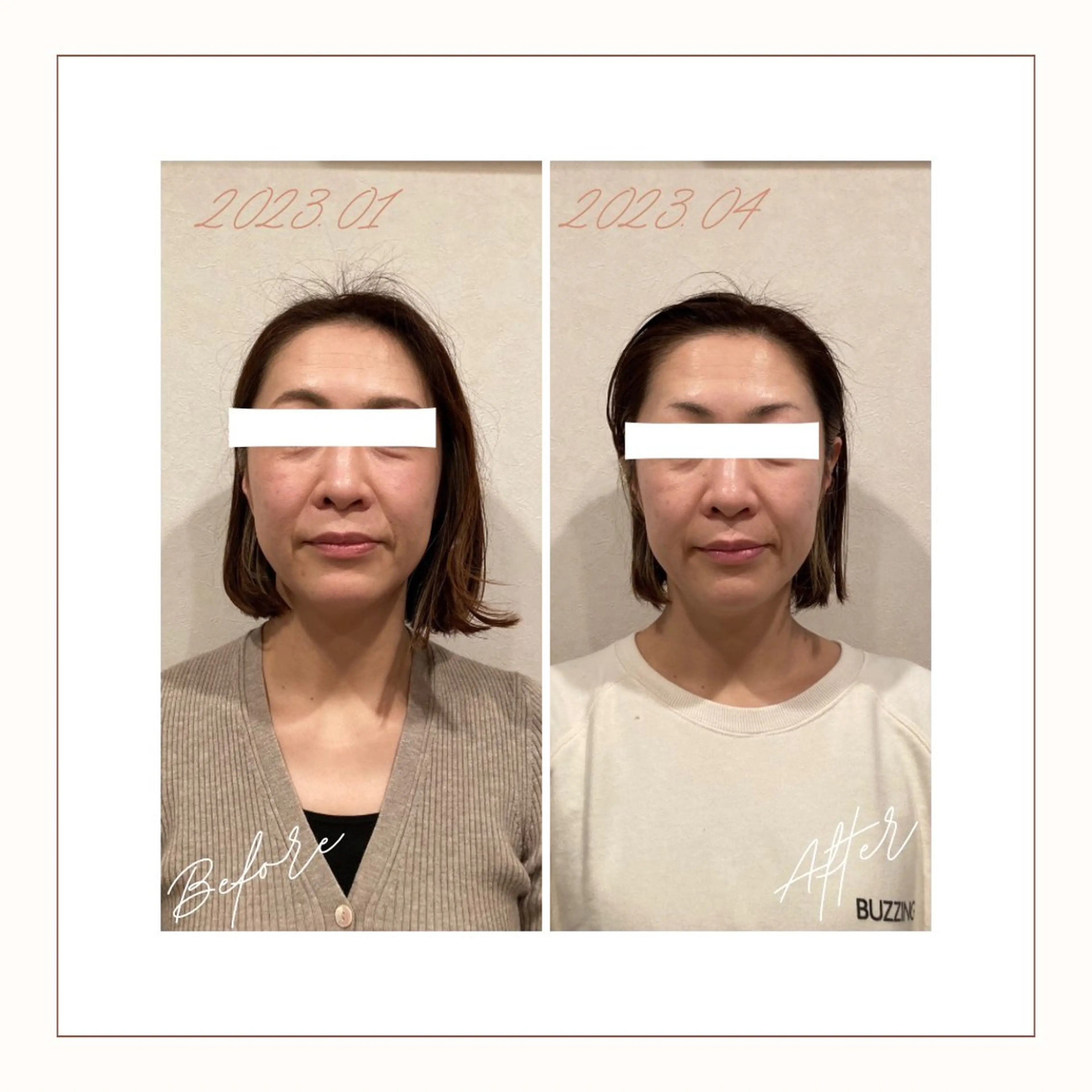 エステ リラク 小顔×肌質改善サロン soin〔ソワン〕のエステ・リラクイメージ